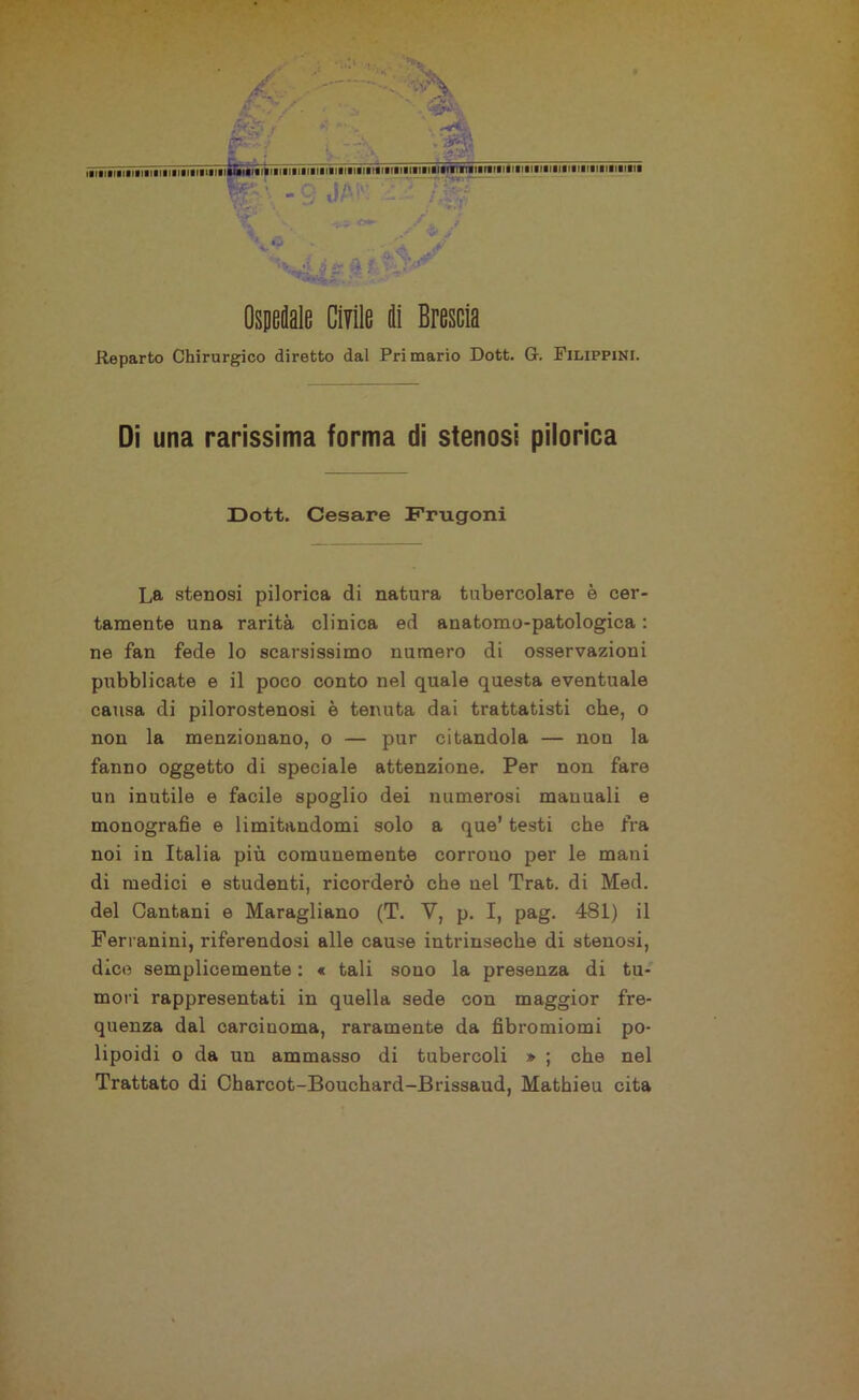 % v w <*- •J A i- iì ? Ospedale Civile di Brescia Reparto Chirurgico diretto dal Primario Dott. G. Filippini. Di una rarissima forma di stenosi piiorica Dott. Cesare Frugoni La stenosi piiorica di natura tubercolare è cer- tamente una rarità clinica ed anatomo-patologica : ne fan fede lo scarsissimo numero di osservazioni pubblicate e il poco conto nel quale questa eventuale causa di pilorostenosi è tenuta dai trattatisti che, o non la menzionano, o — pur citandola — non la fanno oggetto di speciale attenzione. Per non fare un inutile e facile spoglio dei numerosi manuali e monografie e limitandomi solo a que’ testi che fra noi in Italia più comunemente corrouo per le mani di medici e studenti, ricorderò che nel Trat. di Med. del Cantani e Maragliano (T. V, p. I, pag. 481) il Ferranini, riferendosi alle cause intrinseche di stenosi, dico semplicemente : « tali souo la presenza di tu- mori rappresentati in quella sede con maggior fre- quenza dal carcinoma, raramente da fibromiomi po- lipoidi o da un ammasso di tubercoli » ; che nel Trattato di Charcot-Bouchard-Brissaud, Mathieu cita