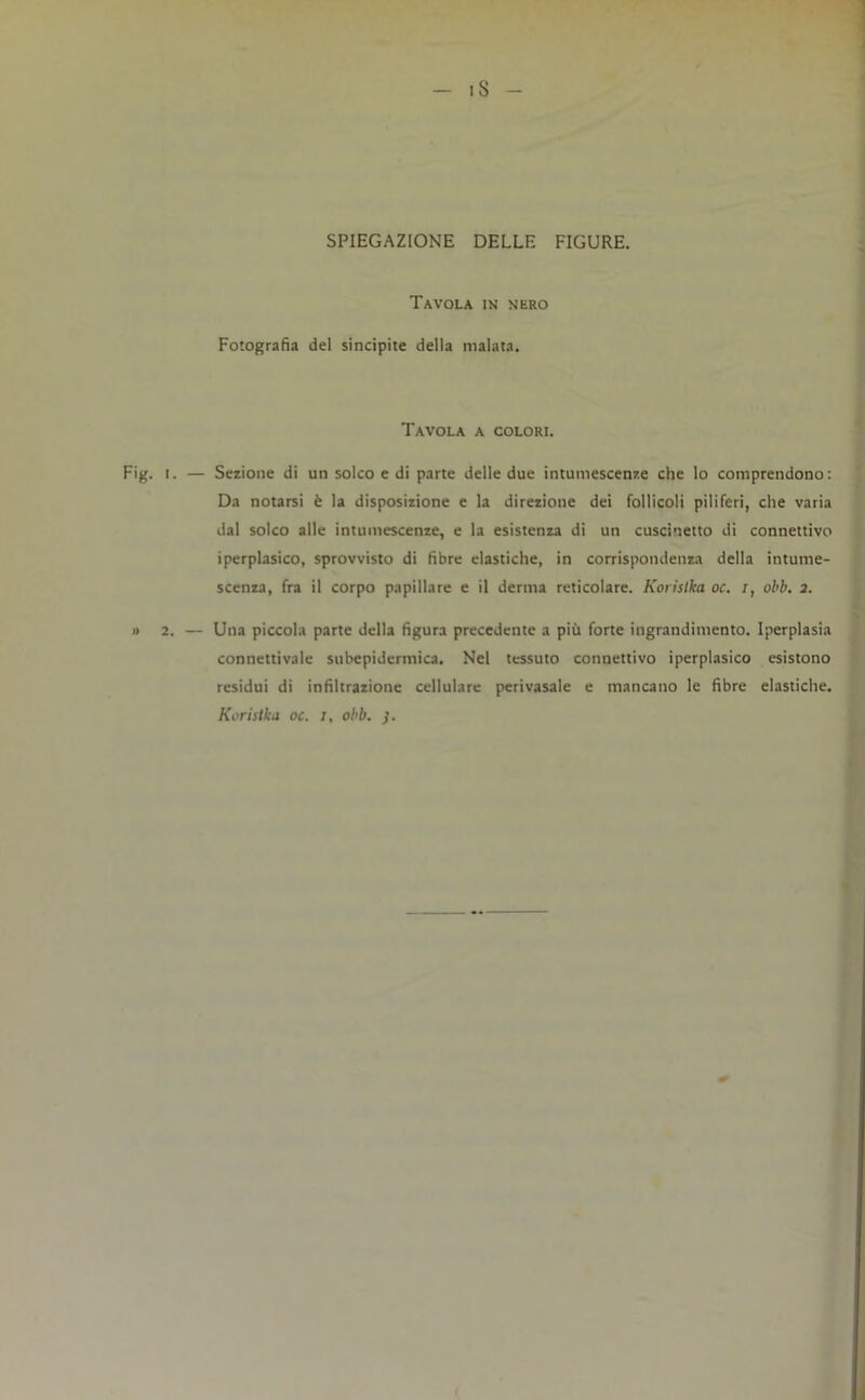 iS SPIEGAZIONE DELLE FIGURE. Tavola in nero Fotografia del sincipite della malata. Tavola a colori. Fig. i. — Sezione di un solco e di parte delle due intumescenze che lo comprendono: Da notarsi è la disposizione e la direzione dei follicoli piliferi, che varia dal solco alle intumescenze, e la esistenza di un cuscinetto di connettivo iperplasico, sprovvisto di fibre elastiche, in corrispondenza della intume- scenza, fra il corpo papillare e il derma reticolare. Kovislka oc. /, obb. 2. » 2. — Una piccola parte della figura precedente a più forte ingrandimento. Iperplasia connettivale subepidermica. Nel tessuto connettivo iperplasico esistono residui di infiltrazione cellulare perivasale e mancano le fibre elastiche. Koristka oc. 1, obb. ).