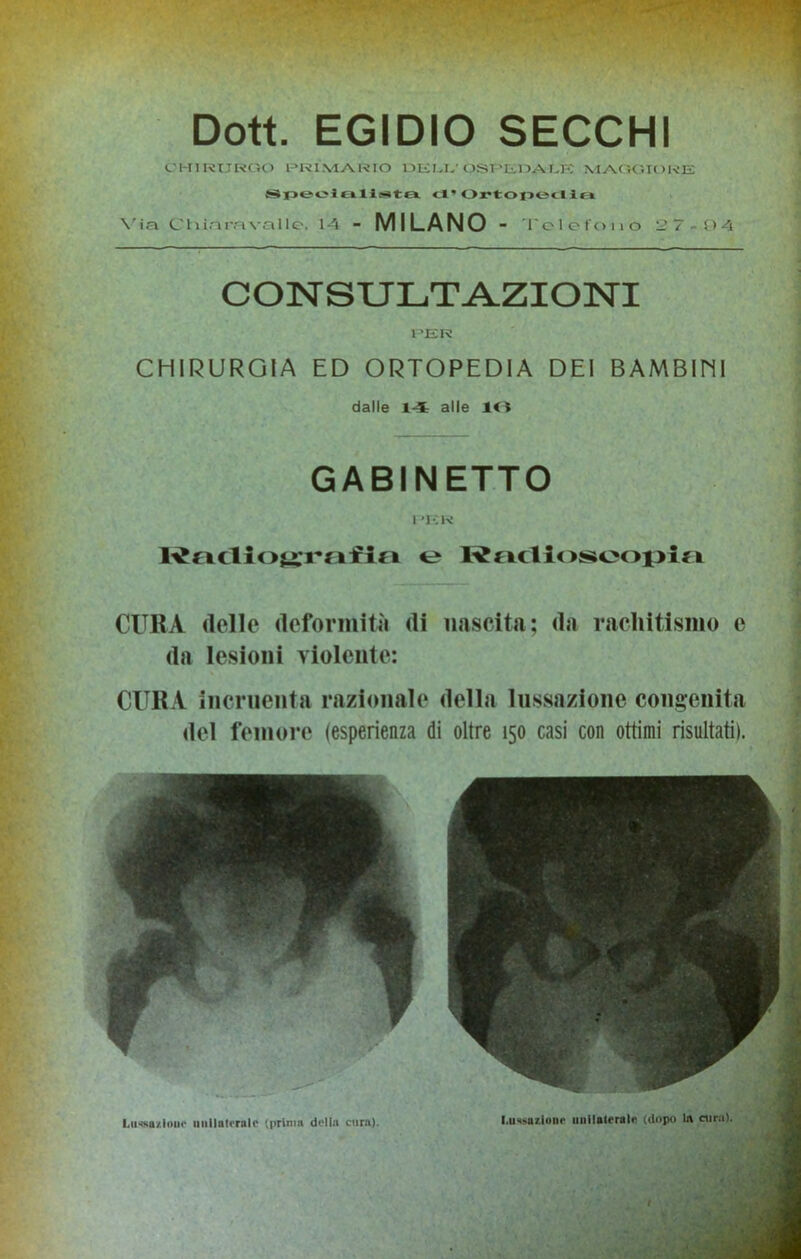 Dott. EGIDIO SECCHI CHIRURGO PRIMARIO DELI; QSr’Ii.OAXE MAGGIORE SpeoluIIsta cl’Ortopeclln Via. Cliiara valle. 14 - MILANO - Telefono 2 7-04 CONSULTAZIONI PER CHIRURGIA ED ORTOPEDIA DEI BAMBIMI dalle 14 alle IO GABINETTO I *K K Radiografia e Radioscopia CURA delle deformità di nascita; da rachitismo e da lesioni violente: CURA incruenta razionale della lussazione congenita del femore (esperienza di oltre 150 casi con ottimi risultati).