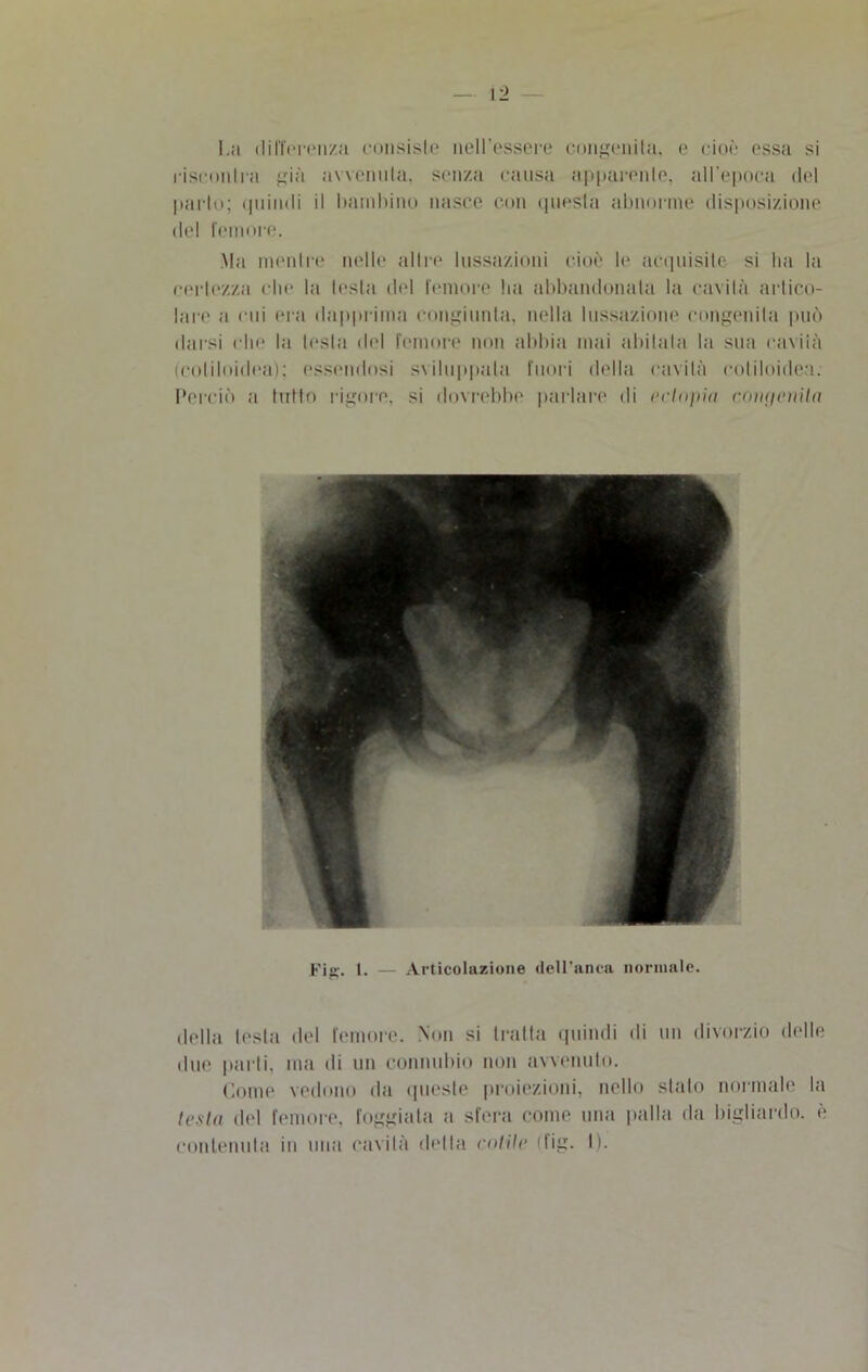 La differenza consiste nell'essere congenita, e cioè essa si riscontra già avvenuta, senza causa apparente, all’epoca del parlo; quindi il bambino nasce con questa abnorme disposizione del femore. Ma mentre nelle altre lussazioni cioè le acquisite si ha la certezza clic la lesta del femore ha abbandonata la cavità artico- lare a cui era dapprima congiunta, nella lussazione congenita può darsi che la lesta del femore non abbia mai abitata la sua cavità (coliloidea); essendosi sviluppala fuori della cavità coliloidea. Perciò a tutto rigore, si dovrebbe parlare di ectopia congenita Fig. I. — Articolazione dell’anca normale. della lesta del femore. Non si tratta quindi di un divorzio delle due parti, ma di un connubio non avvenuto. Come vedono da queste proiezioni, nello stato normale la testa del femore, foggiata a sfera come una palla da bigliardo. è contenuta in una cavità detta colile dig. I).