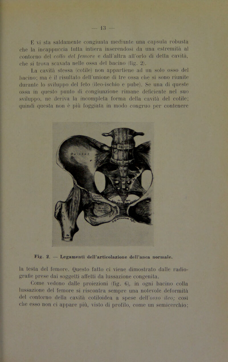 che la incappuccia tutta intiera inserendosi da una estremità al contorno del collo del femore e dall’altra all'orlo di detta cavità, che si trova scavala nelle ossa del bacino (fig. 2). La cavità slessa (colile) non appartiene ad un solo osso del bacino; ma è il risultato dell’unione di tre ossa che si sono riunite durante lo sviluppo del feto (ileo-ischio e pube). Se una di queste ossa in questo punto di congiunzione rimane deficiente nel suo sviluppo, ne deriva la incompleta forma della cavità del colile; quindi questa non è più foggiata in modo congruo per contenere Fig. 2. — Legamenti dell'articolazione dell’anca normale. la testa del femore. Questo fatto ci viene dimostrato dalle radio- grafie prese dai soggetti affetti da lussazione congenita. Come vedono dalle proiezioni (fig. 6), in ogni bacino colla lussazione del femore si riscontra sempre una notevole deformità del contorno della cavità cotiloidea a spese dell’osso ileo; così ohe esso non ci appare più, visto di profilo, come un semicerchio;