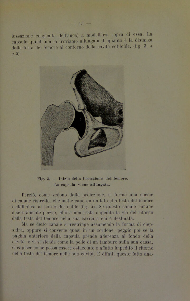 lussazione congenita dell’anca) a modellarsi sopra di essa. La capsula quindi noi la troviamo allungala di quanto e la disianza dalla testa del femore al contorno della cavità cotiloide. (fig. 3, 4 e a). Fig. 3. — Inizio della lussazione del femore. La capsula viene allungata. Perciò, come vedono dalla proiezione, si l'orma una specie di canale ristretto, che mette capo da un lato alla testa del femore e dall’altra al bordo del colile (fig. 4). Se questo canale rimane discretamente pervio, allora non resta impedita la via del ritorno della testa del femore nella sua cavità a cui è destinata. Ma se detto canale si restringe assumendo la forma di clep- sidra, oppure si converte quasi in un cordone, peggio poi se la pagina anteriore della capsula prende aderenza al fondo della cavità, o vi si stende come la pelle di un tamburo sulla sua cassa, si capisce come possa essere ostacolato o affatto impedito il ritorno della testa del femore nella sua cavità. E difatti questo fatto ana-