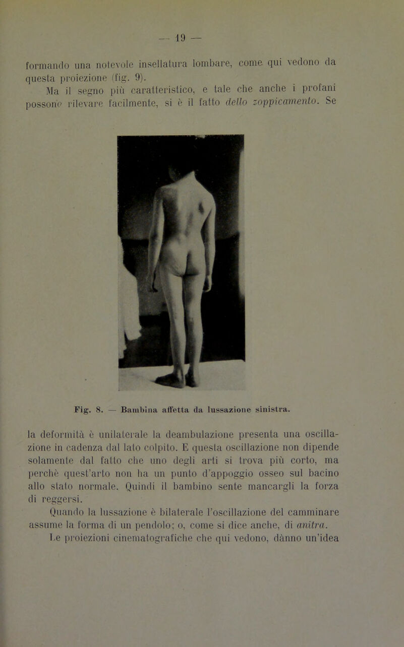 formando una notevole insellatura lombare, come qui vedono da questa proiezione (fig. 9). Ma il segno più caratteristico, e tale che anche i profani possono rilevare facilmente, si è il fatto dello zoppicamento. Se Fig. 8. — Bambina affetta da lussazione sinistra. la deformità è unilaterale la deambulazione presenta una oscilla- zione in cadenza dal lato colpito. E questa oscillazione non dipende solamente dal fatto clic uno degli arti si trova più corto, ma perchè quest’arto non ha un punto d'appoggio osseo sul bacino allo stato normale. Quindi il bambino sente mancargli la forza di reggersi. Quando la lussazione è bilaterale l’oscillazione del camminare assume la forma di un pendolo; o, come si dice anche, di anitra. l.e proiezioni cinematografiche che qui vedono, danno un’idea