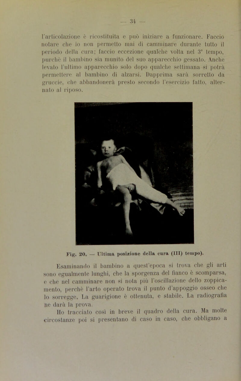 l'articolazione è licostituita e può iniziare a funzionare. Faccio notare che io non permetto mai ili camminare durante lutto il periodo della cura; faccio eccezione qualche volta nel 3° tempo, purché il bambino sia munito del suo apparecchio gessato. Anche levato l'ultimo apparecchio solo dopo qualche settimana si potrà permettere al bambino di alzarsi. Dapprima sarà sorretto da gruccia, clic abbandonerà presto secondo l’esercizio fatto, alter- nalo al riposo. Fig. 20. — Ultima posizione della cura (III) tempo). Esaminando il bambino a quest epoca si trova che gli arti sono egualmente lunghi, che la sporgenza del fianco è scomparsa, e che nel camminare non si nota più l’oscillazione dello zoppica- melo, perchè l’arto operato trova il punto d appoggio osseo che lo sorregge. La guarigione è ottenuta, e stabile. La radiografia ne darà la prova. Ho tracciato così in breve il quadro della cura. Ma molte circostanze poi si presentano di caso in caso, che obbligano a