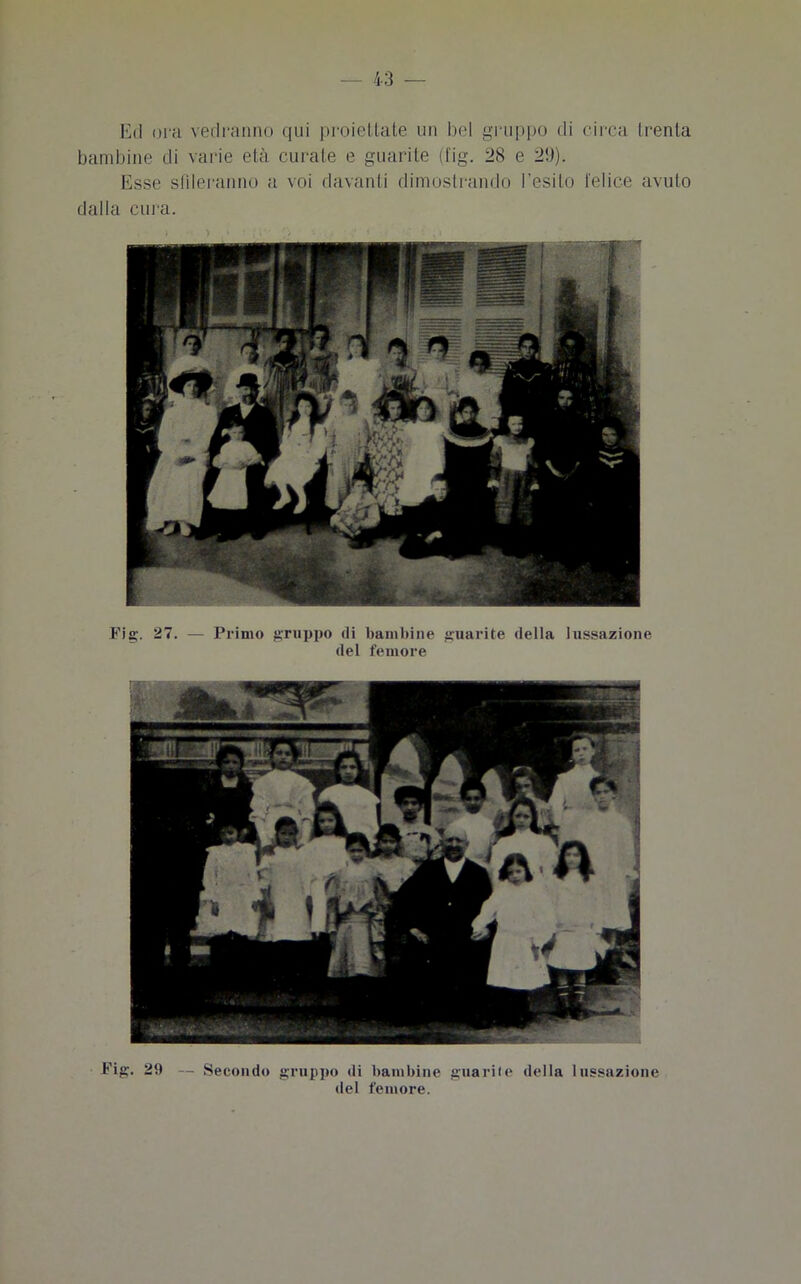 Ed ora vedranno qui proiettate un bel gruppo di circa trenta bambine di varie età curale e guarite (fig. 28 e 29). Esse sfileranno a voi davanti dimostrando l’esito l'elice avuto dalla cura. Fig. 27. — Primo gruppo di bambine guarite della lussazione del femore Fig. 29 — Secondo gruppo di bambine guarite della lussazione del femore.