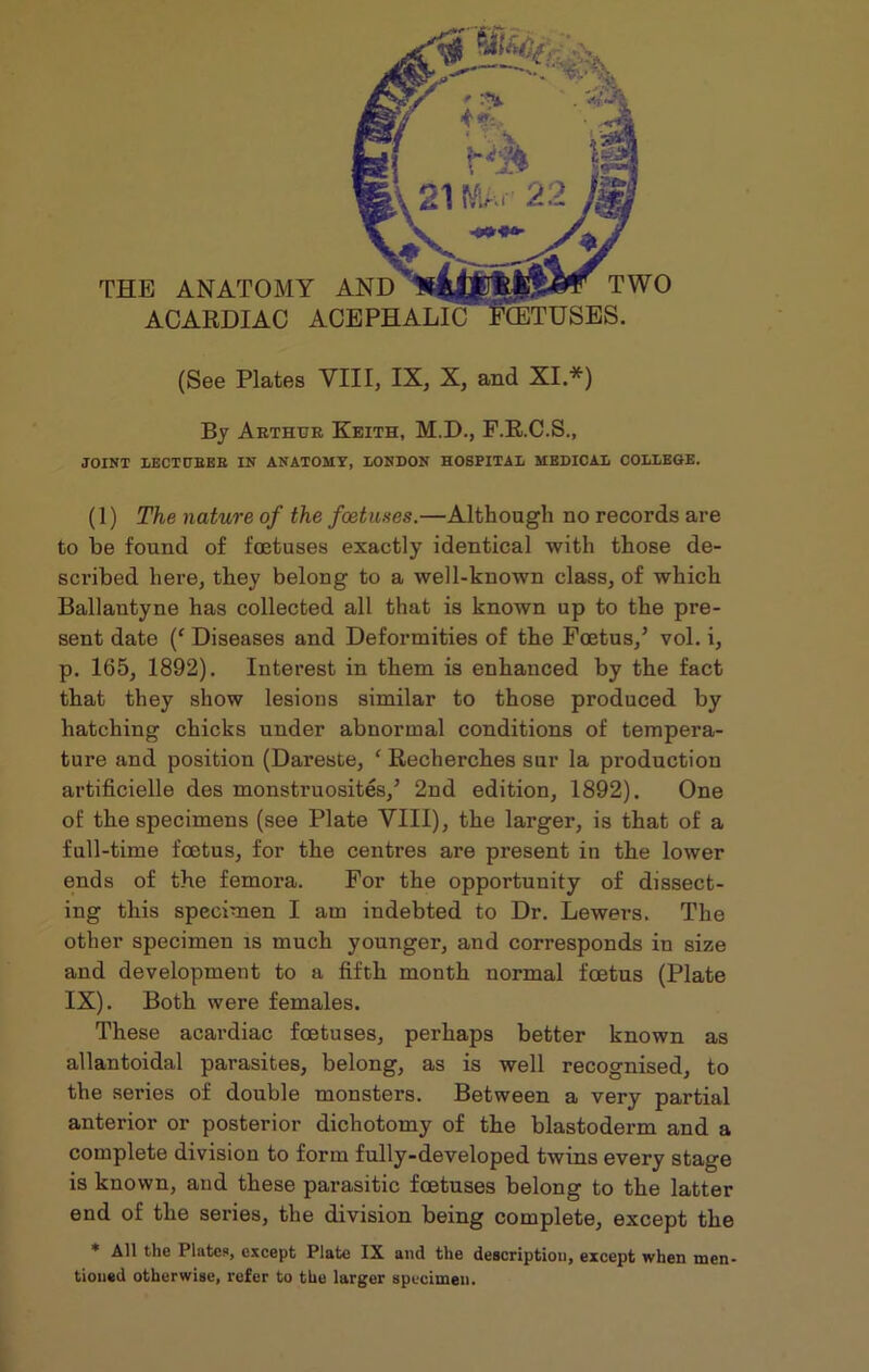 THE ANATOMY AND ACARDIAC ACEPHALI TWO (See Plates VIII, IX, X, and XI.*) By Arthur Keith, M.D., F.R.C.S., JOINT LECTURER IN ANATOMY, LONDON HOSPITAL MEDICAL COLLEGE. (1) The nature of the foetuses.—Although no records are to be found of foetuses exactly identical with those de- scribed here, they belong to a well-known class, of which Ballantyne has collected all that is known up to the pre- sent date (‘ Diseases and Deformities of the Foetus/ vol. i, p. 165, 1892). Interest in them is enhanced by the fact that they show lesions similar to those produced by hatching chicks under abnormal conditions of tempera- ture and position (Dareste, ‘ Recherches sur la production artificielle des monstruosites/ 2nd edition, 1892). One of the specimens (see Plate VIII), the larger, is that of a fall-time foetus, for the centres are present in the lower ends of the femora. For the opportunity of dissect- ing this specimen I am indebted to Dr. Lowers. The other specimen is much younger, and corresponds in size and development to a fifth month normal foetus (Plate IX). Both were females. These acardiac foetuses, perhaps better known as allantoidal parasites, belong, as is well recognised, to the series of double monsters. Between a very partial anterior or posterior dichotomy of the blastoderm and a complete division to form fully-developed twins every stage is known, and these parasitic foetuses belong to the latter end of the series, the division being complete, except the * All the Plates, except Plate IX and the description, except when men- tioned otherwise, refer to the larger specimen.