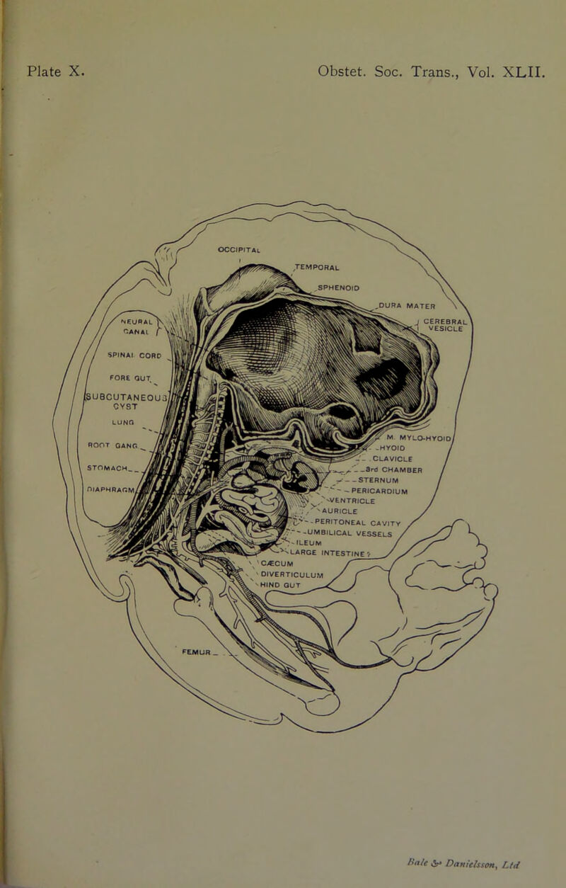 occipital TEMPORAL SPHENOID DURA MATER neural CANAL SPINAI CORD FORE OUT (subcutaneous CY9T / LUNG M myl°-hyo,D( ■ CLAVICLE / Sl ^r.A^--3rd CHAMBER / j*- - STERNUM / - - - PERICARDIUM / '^Mv^v'vVENTR,cle / / >N AU RICLE / SUw’V''' PERITONEAL CAVITY / , -UMBILICAL VESSELS / ileum / LARGE INTESTINE’t V / S C>ECUM r /^N DIVERTICULUM >/ / HIND OUT J V v ^ ROOT GANG STOMACH. DIAPHRAGM, FEMUR Kate & Dan ids son, Ltd