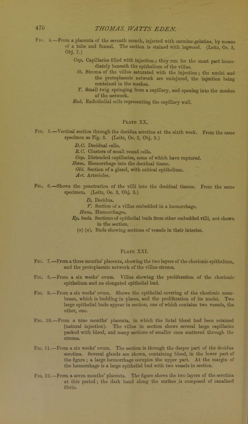 Fro. 4.—From a placenta of the seventh month, injected with carmine-gelatine, by means of a tube and funnel. The section is stained with logwood. (Leitz, Oc. 3, Obj. 7.) Cap. Capillaries filled with injection ; they run for the most part imme- diately beneath the epithelium of the villus. St. Stroma of the villus saturated with the injection; the nuclei and the protoplasmic network are uninjured, the injection being contained in the meshes. T. Small twig springing from a capillary, and opening into the meshes of the network. End. Endothelial cells representing the capillary wall. Plate XX. Fig. 5.—Vertical section through the decidua serotina at the sixth week. From the same specimen as Fig. 3. (Leitz, Oc. 3, Obj. 3.) D.C. Decidual cells. It. C. Clusters of small round cells. Cap. Distended capillaries, some of which have raptured. Ham. Hiemorrhage into the decidual tissue. Old. Section of a gland, with cubical epithelium. Art. Arterioles. Fig. 6.—Shows the penetration of the villi into the decidual tissues. From the same specimen. (Leitz, Oc. 3, Obj. 3.) D. Decidua. V. Section of a villus embedded in a hamorrhage. Ham, Hannorrhages. Ep. buds. Sections of epithelial buds from other embedded villi, not shown in the section. (n) («). Buds showing sections of vessels in their interior. Plate XXL Fig. 7.—From a three months’ placenta, showing the two layers of the chorionic epithelium, and the protoplasmic network of the villus stroma. Fig. 8.—From a six weeks' ovum. Villus showing the proliferation of the chorionic epithelium and an elongated epithelial bud. Fig. 9.—From a six weeks’ ovum. Shows the epithelial covering of the chorionic mem- brane, which is budding in places, and the proliferation of its nuclei. Two large epithelial buds appear in section, one of which contains two vessels, the other, one. Fig. 10.—From a nine months’ placenta, in which the foetal blood had been retained (natural injection). The villus in section shows several large capillaries packed with blood, and many sections of smaller ones scattered through the stroma. Fig. 11.—From a six weeks’ ovum. The section is through the deeper part of the decidua serotina. Several glands are shown, containing blood, in the lower part of the figure ; a large luemorrhage occupies the upper part. At the margin of the hiemorrhage is a large epithelial bud with two vessels in section. Fig. 12.—From a seven months’ placenta. The figure shows the two layers of the serotina at this period ; the dark baud along the surface is composed of canalised fibrin.