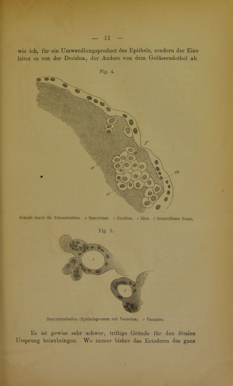 wie ich, für ein Umwandlungsproduct des Epithels, sondern der Eine leitet es von der Decidua, der Andere von dem Gefässendothel ab. Fig. 4. Schnitt dm-ch die Tnbendeoidua. « Syncytium. c Decidua. e Blut. /• Intemllöser Raum. Fig. 5. Syncytiumballen (Epithelsprossen mit Vacuolen). v Vacuolen. Es ist gewiss sehr schwer, triftige Gründe für den fötalen Ursprung beizubringen. Wo immer bisher das Ectoderm des ganz