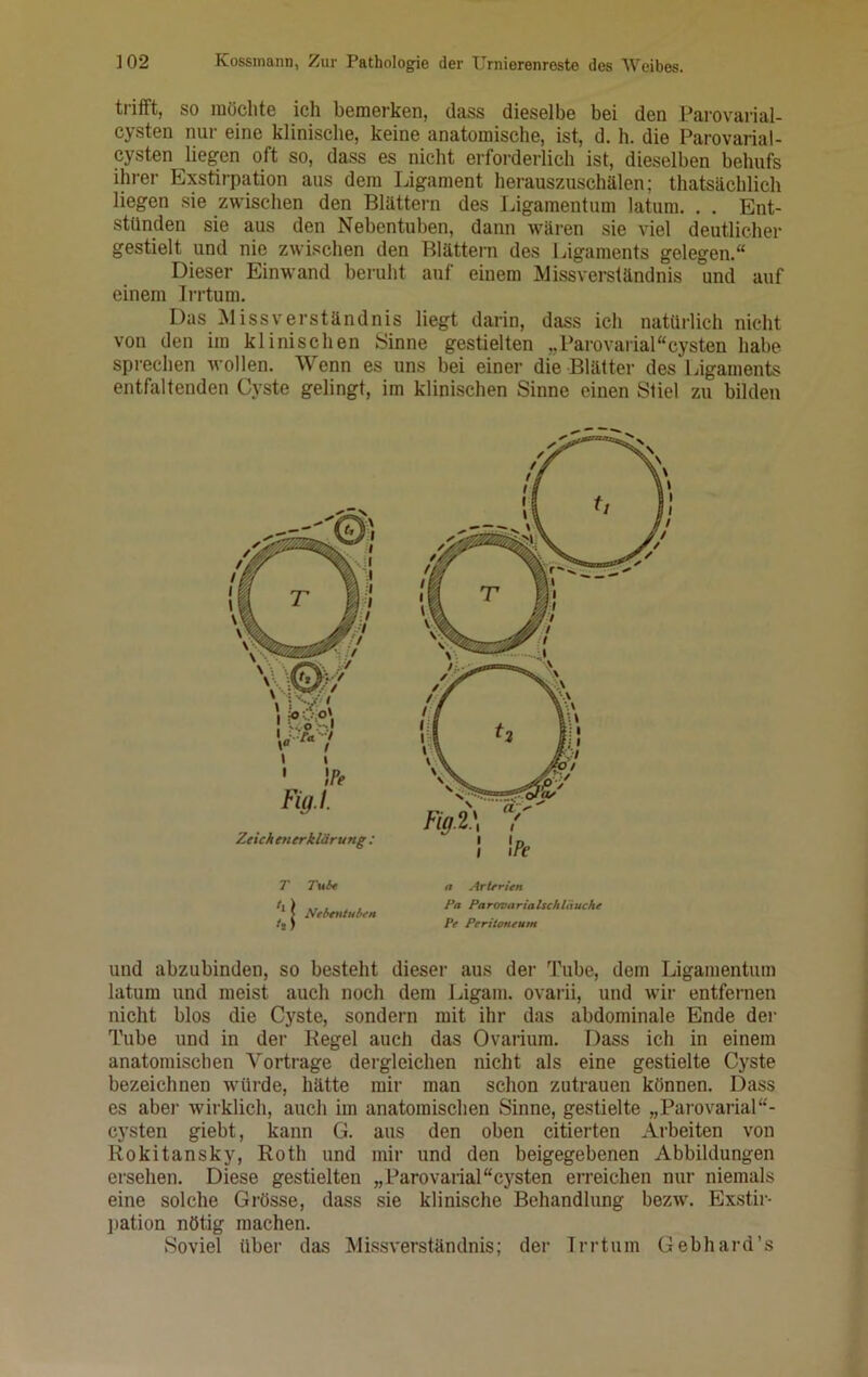 trifft, so möchte ich bemerken, dass dieselbe bei den Parovarial- cysten nur eine klinische, keine anatomische, ist, d. h. die Parovarial- cysten liegen oft so, dass es nicht erforderlich ist, dieselben behufs ihrer Exstirpation aus dem Ligament herauszuschälen; thatsächlich liegen sie zwischen den Blättern des Ligamentum latum. . . Ent- stünden sie aus den Nebentuben, dann wären sie viel deutlicher gestielt und nie zwischen den Blättern des Ligaments gelegen.“ Dieser Einwand beruht auf einem Missverständnis und auf einem Irrtum. Das Missverständnis liegt darin, dass ich natürlich nicht von den im klinischen Sinne gestielten „Parovarial “cysten habe sprechen wollen. Wenn es uns bei einer die Blätter des Ligaments entfaltenden Cyste gelingt, im klinischen Sinne einen Stiel zu bilden und abzubinden, so besteht dieser aus der Tube, dem Ligamentum latum und meist auch noch dem Ligam. ovarii, und wir entfernen nicht blos die Cyste, sondern mit ihr das abdominale Ende der Tube und in der Kegel auch das Ovarium. Dass ich in einem anatomischen Vorträge dergleichen nicht als eine gestielte Cyste bezeichnen würde, hätte mir man schon Zutrauen können. Dass es aber wirklich, auch im anatomischen Sinne, gestielte „Parovarial“- cysten giebt, kann G. aus den oben citierten Arbeiten von Rokitansky, Roth und mir und den beigegebenen Abbildungen ersehen. Diese gestielten „Parovarial“cysten erreichen nur niemals eine solche Grösse, dass sie klinische Behandlung bezw. Exstir- pation nötig machen. Soviel über das Missverständnis; der Irrtum Gebhard’s T Tut* n Arterien Pa Parovarialschliiuche Pf Peritoneum
