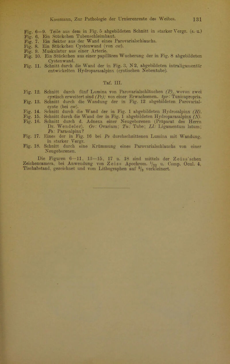 Fig. 6—9. Teile aus dem in Fig. 5 abgebildeten Schnitt in starker Yergr. (s. u.) Fig. 6. Ein Stückchen Tubenschleimhaut. Fig. 7. Ein Sektor aus der Wand eines Parovarialschlauchs. Fig. 8. Ein Stückchen Cystenwand (von civ). Fig. 9. Muskulatur aus einer Arterie. Fig. 10. Ein Stückchen aus einer papillären Wucherung der in Fig. 8 abgebildeten Cysten wand. Fig. 11. Schnitt durch die Wand der in Fig. 3, N2, abgebildeten intraligamentär entwickelten Hydroparasalpinx (cystischen Nebentube). Taf. ni. Fig. 12. Schnitt durch fünf Lumina von Parovarialschläuchen (P), wovon zwei cystisch erweitert sind (Pc); von einer Erwachsenen, tpr: Tunicapropria. Fig. 13. Schnitt durch die Wandung der in Fig. 12 abgebildeten Parovarial- cyste (bei cw). Fig. 14. Schnitt durch die Wand der in Fig. 1 abgebildeten Hydrosalpinx (H). Fig. 15. Schnitt durch die Wand der in Fig. 1 abgebildeten Hydroparasalpinx (N). Fig. 16. Schnitt durch d. Adnexa einer Neugeborenen (Präparat des Herrn Dr. Wendeier). Ov: Ovarium; Tu: Tube; LI: Ligamentum latum; Ps: Parasalpinx? Fig. 17. Eines der in Fig. 16 bei Ps durchschnittenen Lumina mit Wandung, in starker Vergr. Fig. 18. Schnitt durch eine Krümmung eines Parovarialschlauchs von einer Neugeborenen. Die Figuren 6—11, 13—15, 17 u. 18 sind mittels der Zeiss’schen Zeichencamera, bei Anwendung von Zeiss Apochrom. ’/ia u- Comp. Ocul. 4, Tischabstand, gezeichnet und vom Lithographen auf 2/3 verkleinert.