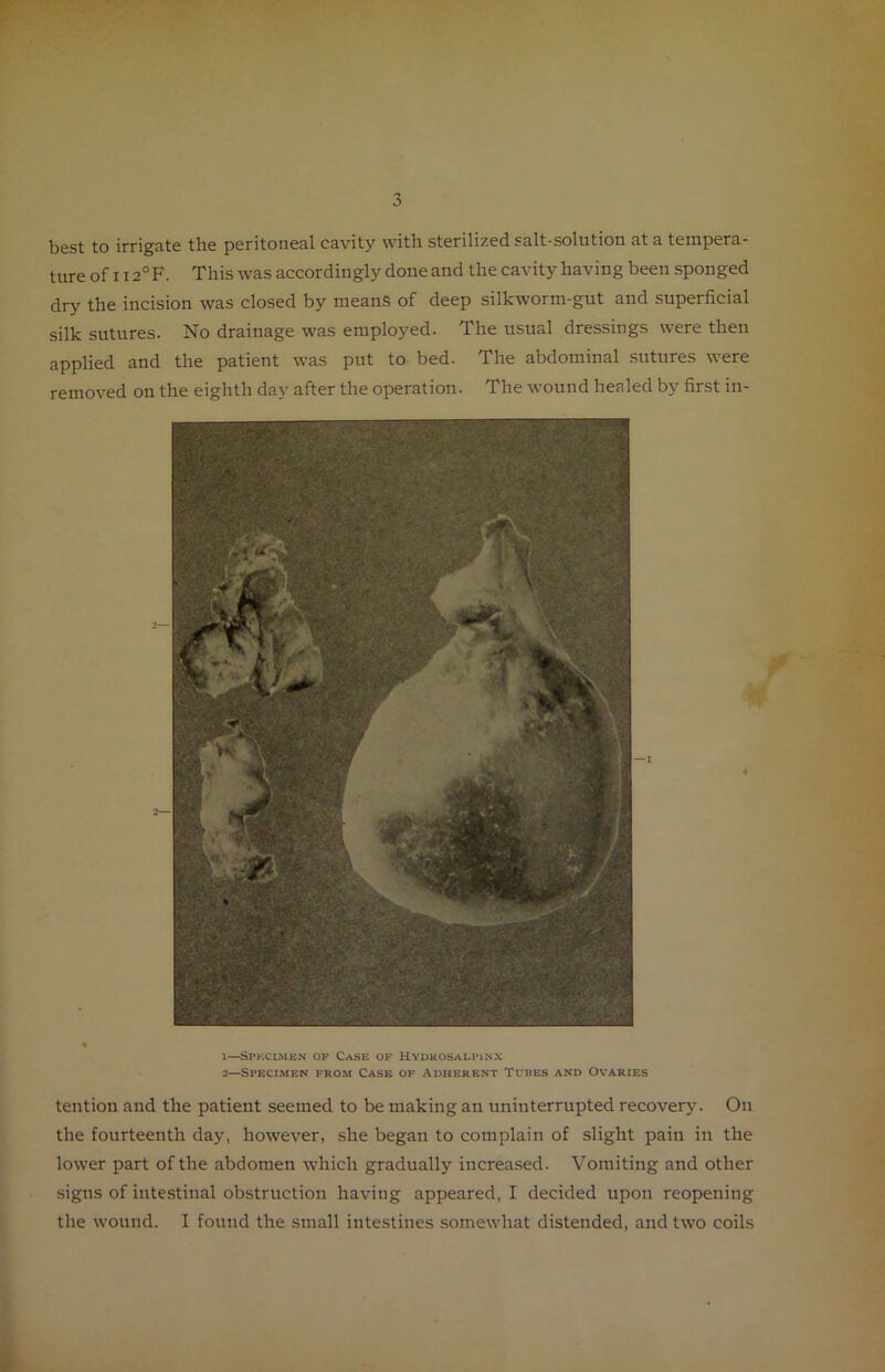 best to irrigate tlie peritoneal cavity witli sterilized salt-solution at a tempera- ture of 112°F. This was accordingly done and the cavity having been sponged dry the incision was closed by means of deep silkworm-gut and superficial silk sutures. No drainage was emploj^ed. The usual dressings were then applied and the patient was put to bed. The abdominal sutures were removed on the eighth day after the operation. The wound healed by first in- 1— Specimen of Case of Hvuuosali'isx 2— Specimen from Case of Adherent Tubes and Ovaries tention and the patient seemed to be making an uninterrupted recovery. On the fourteenth day, however, she began to complain of slight pain in the lower part of the abdomen which gradually increased. Vomiting and other signs of intestinal obstruction having appeared, I decided upon reopening the wound. I found the small intestines somewhat distended, and two coils