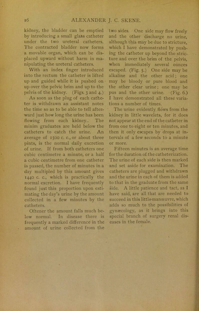 kidney, the bladder can be emptied by introducing a small glass catheter under the two ureteral catheters. The contracted bladder now forms a movable organ, which can be dis- placed upward without harm in ma- nipulating the ureteral catheters. With an index finger introduced into the rectum the catheter is lifted up and guided while it is pushed on up over the pelvic brim and up to the pelvis of the kidney. (Figs. 3 and 4.) As soon as the plug of each cathe- ter is withdrawn an assistant notes the time so as to be able to tell after- ward just how long the urine has been flowing from each kidney.. The minim graduates are held below the catheters to catch the urine. An average of 1500 c. c., or about three pints, is the normal daily excretion of urine. If from both catheters one cubic centimetre a minute, or a half a cubic centimetre from one catheter is passed, the number of minutes in a day multipled by this amount gives 1440 c. c., which is practically the normal excretion. I have frequently found just this proportion upon esti- mating the day’s urine by the amount collected in a few minutes by the catheters. Ot'tener the amount falls much be- low normal. In disease there is frequently a marked difference in the amount of urine collected from the two sides. One side may flow freely and the other discharge no urine, although this may be due to stricture, which I have demonstrated by push- ing the catheter up beyond the stric- ture and over the brim of the pelvis, when immediately several ounces escaped. (Fig. 5.) One side may be alkaline and the other acid; one may be bloody or pure blood and the other clear urine; one may be pus and the other urine. (Fig. 6.) I have demonstrated all these varia- tions a number of times. The urine evidently flows from the kidney in little wavelets, for it does not appear at the end of the catheter in from one to eight or ten minutes, and then it only escapes by drops at in- tervals of a few seconds to a minute or more. Fifteen minutes is an average time for the duration of the catheterization. The urine of each side is then marked and set aside for examination. The catheters are plugged and withdrawn and the urine in each of them is added to that in the graduate from the same side. A little patience and tact, as I have said, are all that are needed to succeed in this littlemanceuvre, which adds so much to the possibilities of gynaecology, as it brings into this special branch of surgery renal dis- eases in the female.