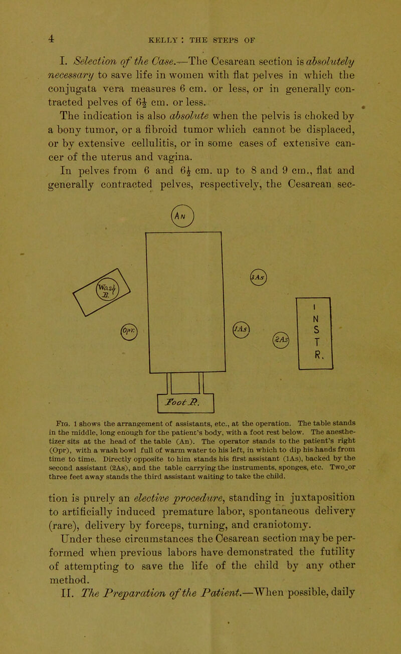 I. Selection of the Case— The Cesarean section is absolutely necessary to save life in women with fiat pelves in which the conjngata vera measures 6 cm. or less, or in generally con- tracted pelves of 6^ cm. or less. The indication is also absohote when the pelvis is choked by a bony tumor, or a fibroid tumor which cannot be displaced, or by extensive cellulitis, or in some cases of extensive can- cer of the uterus and vagina. In pelves from 6 and 6£ cm. up to 8 and 9 cm., flat and generally contracted pelves, respectively, the Cesarean sec- Fig. 1 shows the arrangement of assistants, etc., at the operation. The table stands in the middle, long enough for the patient’s body, with a foot rest below. The anesthe- tizer sits at the head of the table (An). The operator stands to the patient’s right (Opr), with a wash bowl full of warm -water to his left, in which to dip his hands from time to time. Directly opposite to him stands his first assistant (lAs), backed by the second assistant (2As), and the table carrying the instruments, sponges, etc. Two.or three feet away stands the third assistant waiting to take the child. tion is purely an elective procedure, standing in juxtaposition to artificially induced premature labor, spontaneous delivery (rare), delivery by forceps, turning, and craniotomy. Under these circumstances the Cesarean section may be per- formed when previous labors have demonstrated the futility of attempting to save the life of the child by any other method. If. The Preparation of the Patient.—When possible, daily