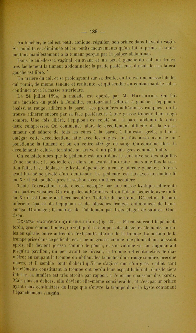 Au toucher, le col est petit, conique, régulier, son orifice dans l’axe du vagin. Sa mobilité est diminuée cl les petits mouvements qu’on lui imprime se trans- mettent manifestement à la tumeur perçue par le palper abdominal. Dans le cul-de-sac vaginal, en avant et un peu ;\ gauche du col, on trouve très facilement la tumeur abdominale; la partie postérieure du cul-de-sac latéral gauche est libre. ' En arrière du col, et se prolongeant sur sa droite, on trouve une masse lobulée qui paraît, de même, tendue et rénitente, et qui semble en contournant le col se continuer avec la masse antérieure. Le 24 juillet 1894, la malade est opérée par M. Hartmann. On fait une incision du pubis à l’ombilic, contournant celni-ci à gauche; l’épiploon, épaissi et rouge, adhère à la paroi; ces premières adhérences rompues, on le trouve adhérer encore par sa face postérieure à une grosse tumeur d’un rouge sombre. Une fois libéré, l’épiploon est rejeté sur la paroi abdominale entre deux compresses. On commence alors le décollement difficile de la grosse tumeur qui adhère de tous les côtés à la paroi, cà l’intestin grêle, à l’anse oméga; cette décortication, faite avec les ongles, une fois assez avancée, on ponctionne la tumeur et on en retire 400 gr. de sang. On continue alors le décollement; celui-ci terminé, on arrive à un pédicule gros comme l’index. On constate alors que le pédicule est tordu dans le sens inverse des aiguilles d’une montre ; le pédicule est alors en avant et droite, mais une fois la sec- tion faite, il se déplace ; le kyste dépend de la corne utérine gauche ; l’utérus avait lui-même pivoté d’un demi-tour. Le pédicule est fait avec un double fil en X ; il est louché après la section avec un thermocautère. Toute l’excavation reste encore occupée par une masse kystique adhérente aux parties voisines. On rompt les adhérences et on fait un pédicule avec un fil en X ; il est louché au thermocautère. Toilette du péritoine. Résection du bord inférieur épaissi de l’épiploon et de plusieurs franges enflammées de l’anse oméga. Drainage ; fermeture de l’abdomen par trois étages de sutures. Gué- rison. Examen macroscopique des pièces (lig. 20).—En considérant le pédicule tordu, gros comme l’index, on voit qu’il se compose de plusieurs éléments enrou- lés en spirale, entre autres de l’extrémité utérine de la trompe. La portion de la trompe prise dans ce pédicule est à peine grosse comme une plume d’oie ; aussitôt après, elle devient grosse comme le pouce, et son volume va en augmentant jusqu’au pavillon ; un peu avant ce niveau, la trompe a 4 centimètres de dia- mètre; en coupant la trompe on obtientdes tranches d’un rouge sombre, presque noires, et il semble tout d’abord qu’il ne s’agisse que d’un gros caillot tant les éléments constituant la trompe ont perdu leur aspect habituel ; dans le tiers interne, la lumière est très étroite par rapport à l’énorme épaisseur des parois. Mais plus en dehors, elle devient elle-même considérable, et c’est par un orifice ayant deux centimètres de large que s’ouvre la trompe dans le kyste contenant l’épanchement sanguin.