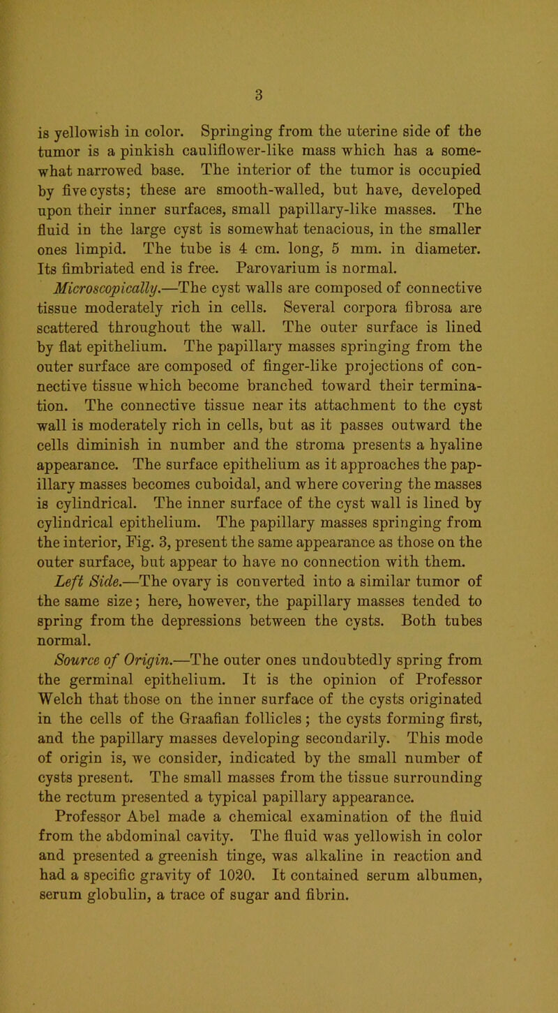 is yellowish in color. Springing from the uterine side of the tumor is a pinkish cauliflower-like mass which has a some- what narrowed base. The interior of the tumor is occupied by five cysts; these are smooth-walled, but have, developed upon their inner surfaces, small papillary-like masses. The fluid in the large cyst is somewhat tenacious, in the smaller ones limpid. The tube is 4 cm. long, 5 mm. in diameter. Its fimbriated end is free. Parovarium is normal. Microscopically.—The cyst walls are composed of connective tissue moderately rich in cells. Several corpora fibrosa are scattered throughout the wall. The outer surface is lined by flat epithelium. The papillary masses springing from the outer surface are composed of finger-like projections of con- nective tissue which become branched toward their termina- tion. The connective tissue near its attachment to the cyst wall is moderately rich in cells, but as it passes outward the cells diminish in number and the stroma presents a hyaline appearance. The surface epithelium as it approaches the pap- illary masses becomes cuboidal, and where covering the masses is cylindrical. The inner surface of the cyst wall is lined by cylindrical epithelium. The papillary masses springing from the interior, Pig. 3, present the same appearance as those on the outer surface, but appear to have no connection with them. Left Side.—The ovary is converted into a similar tumor of the same size; here, however, the papillary masses tended to spring from the depressions between the cysts. Both tubes normal. Source of Origin.—The outer ones undoubtedly spring from the germinal epithelium. It is the opinion of Professor Welch that those on the inner surface of the cysts originated in the cells of the Graafian follicles ; the cysts forming first, and the papillary masses developing secondarily. This mode of origin is, we consider, indicated by the small number of cysts present. The small masses from the tissue surrounding the rectum presented a typical papillary appearance. Professor Abel made a chemical examination of the fluid from the abdominal cavity. The fluid was yellowish in color and presented a greenish tinge, was alkaline in reaction and had a specific gravity of 1020. It contained serum albumen, serum globulin, a trace of sugar and fibrin.