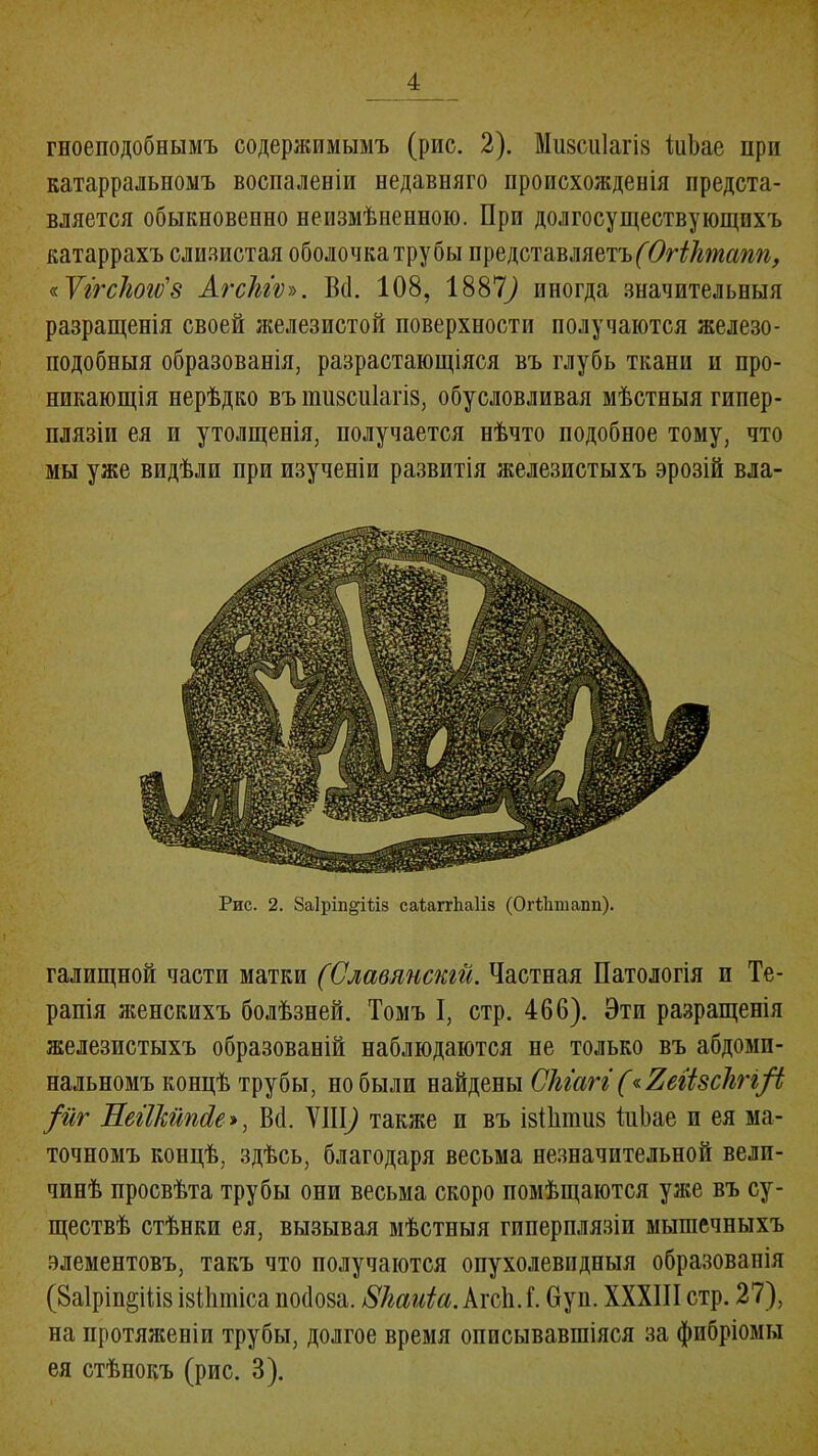 гноеподобнымъ содержимымъ (рис. 2). Мизсиіагіз ІиЬае при катарральномъ воспаленіи недавняго происхожденія предста- вляется обыкновенно неизмѣненною. При долгосуществующихъ катаррахъ слизистая оболочка трубы представляетъ(ОгШпапп, «Ѵггсіюгѵ'з АгсЫѵ». Вй. 108, 1887^ иногда значительныя разращенія своей железистой поверхности получаются железо- подобныя образованія, разрастающіяся въ глубь ткани и про- никающія нерѣдко въ тіізсиіагіз, обусловливая мѣстныя гипер- плазіи ея и утолщенія, получается нѣчто подобное тому, что мы уже видѣли при изученіи развитія железистыхъ эрозій вла- Рис. 2. 8аІріп§;Ш8 саіаггііаііз (ОгЫішапп). галищной части матки (Славянскій. Частная Патологія п Те- рапія женскихъ болѣзней. Томъ I, стр. 466). Эти разращенія железистыхъ образованій наблюдаются не только въ абдоми- нальномъ концѣ трубы, но были найдены СЫагг («Яеіізсіігі/І $йг ЕегІЫпсІе», В<1. VIII) также и въ ізіішіиз ІиЬае п ея ма- точномъ концѣ, здѣсь, благодаря весьма незначительной вели- чинѣ просвѣта трубы они весьма скоро помѣщаются уже въ су- ществѣ стѣнки ея, вызывая мѣстныя гиперплязіп мышечныхъ элементовъ, такъ что получаются опухолевидныя образованія (8а1ріп§ііІ8 ізПшііса посіоза. 81іаиіа.кхоАЛ. Пуп. XXXIII стр. 27), на протяженіи трубы, долгое время описывавшіяся за фпбріомы