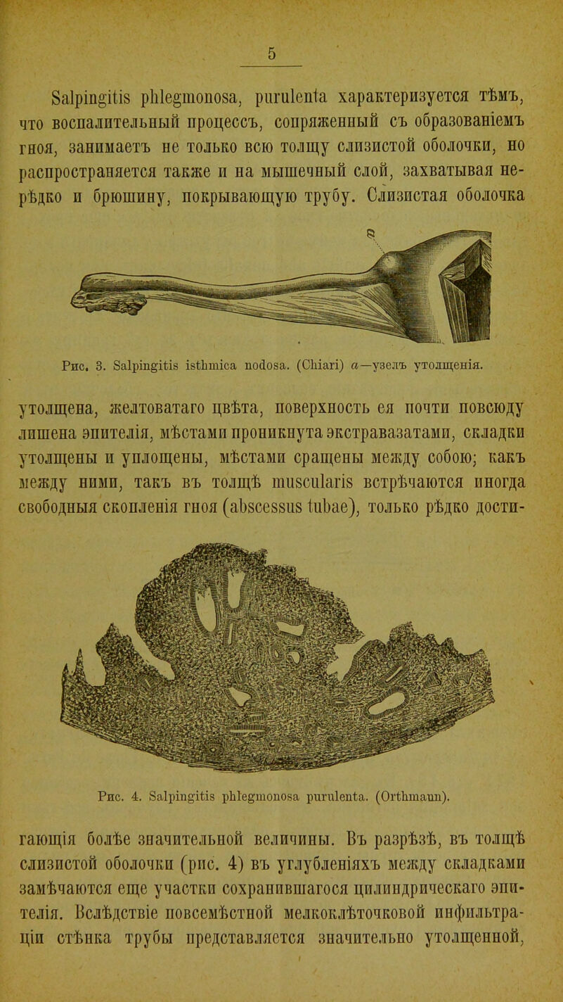 г-4 8а1ріп§ііі8 рЫермноза, ригиіепіа характеризуется тѣмъ, что воспалительный процессъ, сопряженный съ образованіемъ гноя, занимаетъ не только всю толщу слизистой оболочки, но распространяется также и на мышечный слой, захватывая не- рѣдко и брюшину, покрывающую трубу. Слизистая оболочка Рис. 3. 8а1ріп§'Шз ізіѣтіса пойоза. (СЫагі) а—узелъ утолщенія. утолщена, желтоватаго цвѣта, поверхность ея почти повсюду лишена эпителія, мѣстами проникнута экстравазатами, складки утолщены и уплощены, мѣстами сращены между собою; какъ между ними, такъ въ толщѣ ппі8си1агІ8 встрѣчаются иногда свободныя скопленія гноя (а1)8се88іі8 іиЬае), только рѣдко дости- Рис. 4. 8а1ріп§'Шз рЫе§шопоза ригиіепіа. (ОгіЬшаии). гающія болѣе значительной величины. Въ разрѣзѣ, въ толщѣ слизистой оболочки (рис. 4) въ углубленіяхъ между складками замѣчаются еще участки сохранившагося цилиндрическаго эпи- телія. Вслѣдствіе повсемѣстной мелкоклѣточковой инфильтра- ціи стѣнка трубы представляется значительно утолщенной, і