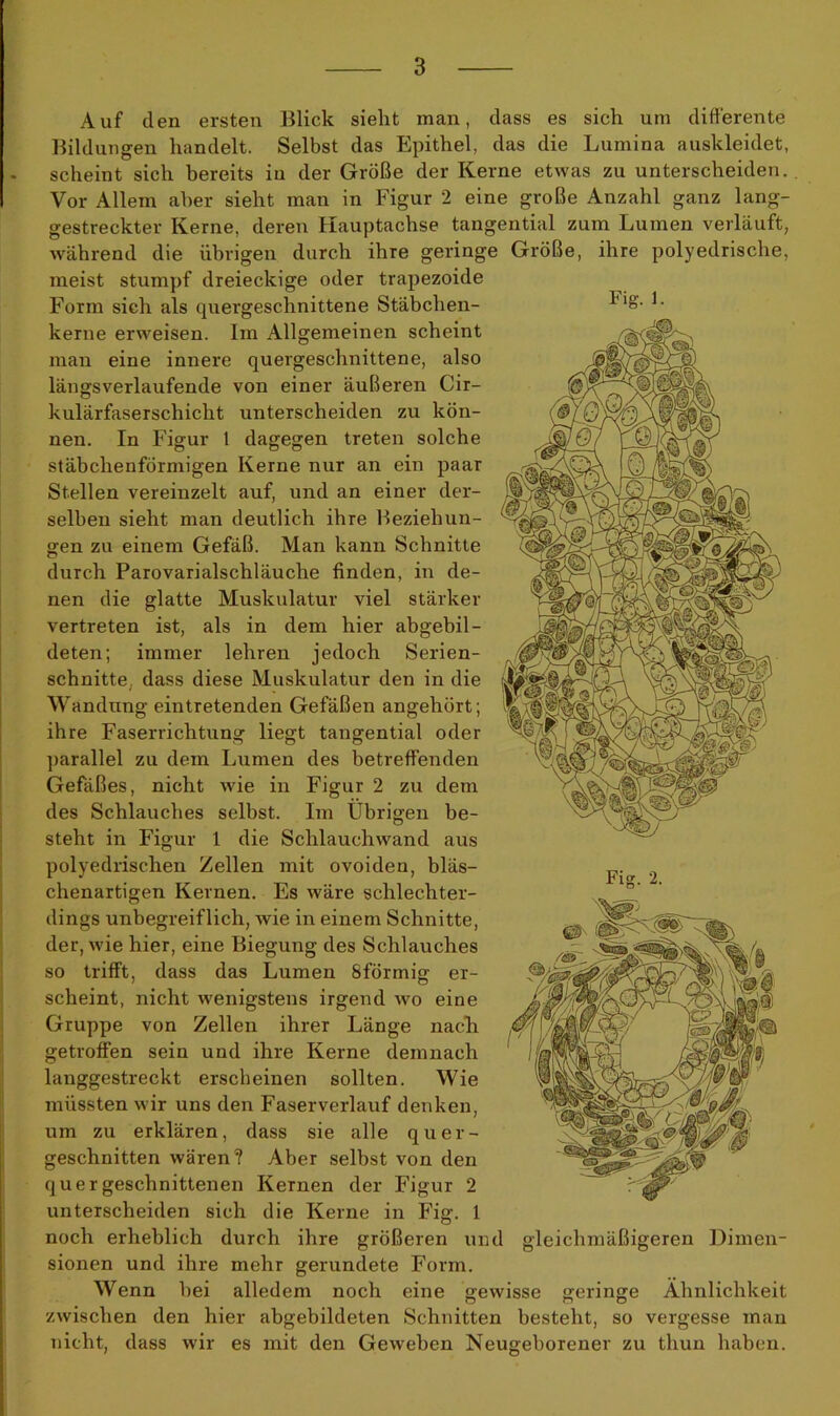 Fig. 1. Auf den ersten Blick sieht man, dass es sich um differente Bildungen handelt. Selbst das Epithel, das die Lumina auskleidet, scheint sich bereits in der Größe der Kerne etwas zu unterscheiden. Vor Allem aber sieht man in Figur 2 eine große Anzahl ganz lang- gestreckter Kerne, deren Hauptachse tangential zum Lumen verläuft, während die übrigen durch ihre geringe Größe, ihre polyedrische, meist stumpf dreieckige oder trapezoide Form sich als quergeschnittene Stäbchen- kerne erweisen. Im Allgemeinen scheint man eine innere quergeschnittene, also längsverlaufende von einer äußeren Cir- kulärfaserschicht unterscheiden zu kön- nen. In Figur 1 dagegen treten solche stäbchenförmigen Kerne nur an ein paar Stellen vereinzelt auf, und an einer der- selben sieht man deutlich ihre Beziehun- gen zu einem Gefäß. Man kann Schnitte durch Parovarialschläuche finden, in de- nen die glatte Muskulatur viel stärker vertreten ist, als in dem hier abgebil- deten; immer lehren jedoch Serien- schnitte, dass diese Muskulatur den in die Wandung eintretenden Gefäßen angehört; ihre Faserrichtung liegt tangential oder parallel zu dem Lumen des betreffenden Gefäßes, nicht wie in Figur 2 zu dem des Schlauches selbst. Im Übrigen be- steht in Figur 1 die Schlauchwand aus polyedrischen Zellen mit ovoiden, bläs- chenartigen Kernen. Es wäre schlechter- dings unbegreiflich, wie in einem Schnitte, der, wie hier, eine Biegung des Schlauches so trifft, dass das Lumen Sförmig er- scheint, nicht wenigstens irgend wo eine Gruppe von Zellen ihrer Länge nach getroffen sein und ihre Kerne demnach langgestreckt erscheinen sollten. Wie müssten wir uns den Faserverlauf denken, um zu erklären, dass sie alle quer- geschnitten wären? Aber selbst von den quer geschnittenen Kernen der Figur 2 unterscheiden sich die Kerne in Fig. 1 noch erheblich durch ihre größeren und gleichmäßigeren Dimen- sionen und ihre mehr gerundete Form. Wenn bei alledem noch eine gewisse geringe Ähnlichkeit zwischen den hier abgebildeten Schnitten besteht, so vergesse man nicht, dass wir es mit den Geweben Neugeborener zu tliun haben. Fis;. 2.