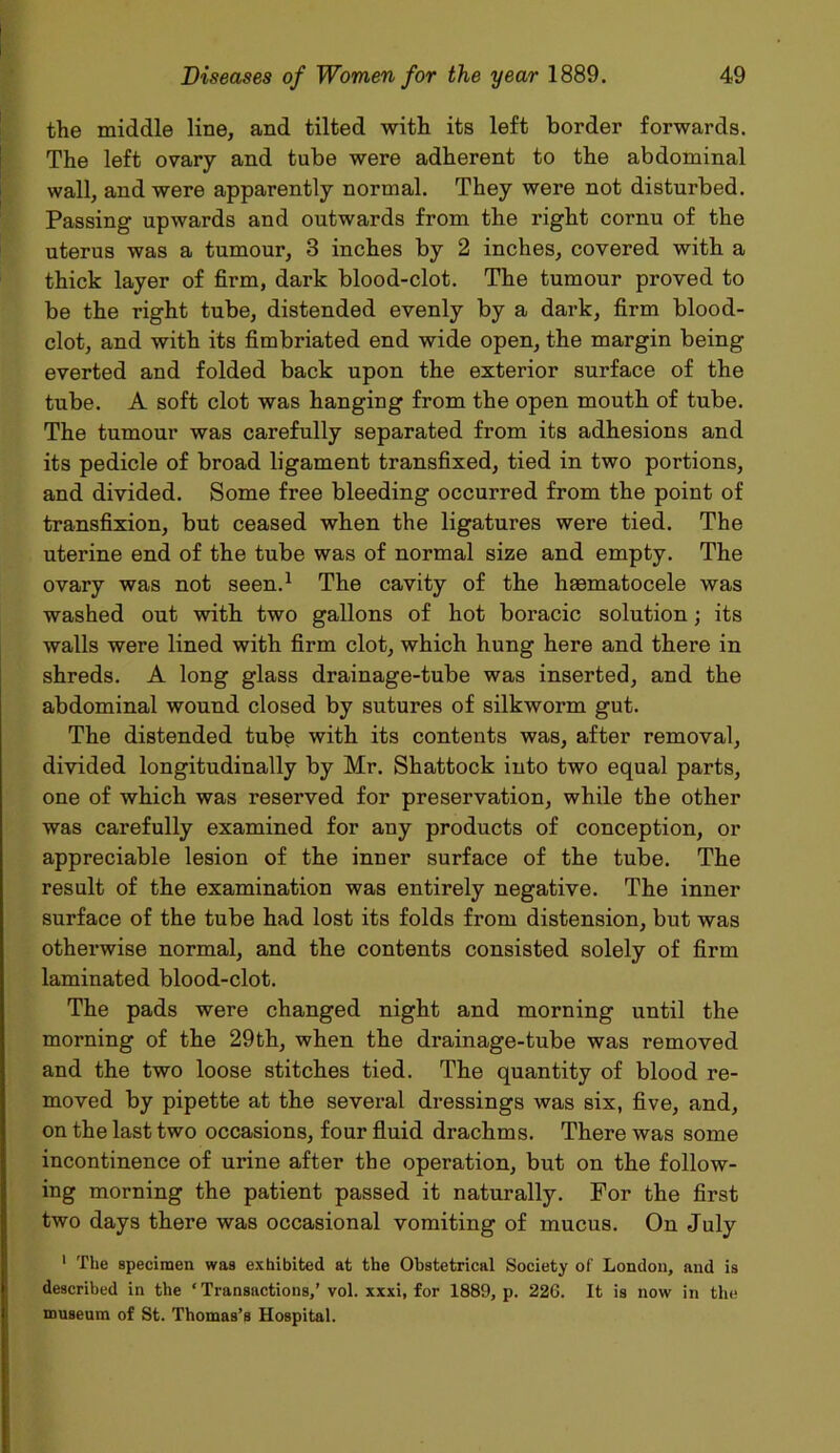 the middle line, and tilted with its left border forwards. The left ovary and tube were adherent to the abdominal wall, and were apparently normal. They were not disturbed. Passing upwards and outwards from the right cornu of the uterus was a tumour, 3 inches by 2 inches, covered with a thick layer of firm, dark blood-clot. The tumour proved to be the right tube, distended evenly by a dark, firm blood- clot, and with its fimbriated end wide open, the margin being everted and folded back upon the exterior surface of the tube. A soft clot was hanging from the open mouth of tube. The tumour was carefully separated from its adhesions and its pedicle of broad ligament transfixed, tied in two portions, and divided. Some free bleeding occurred from the point of transfixion, but ceased when the ligatures were tied. The uterine end of the tube was of normal size and empty. The ovary was not seen.1 The cavity of the hsematocele was washed out with two gallons of hot boracic solution; its walls were lined with firm clot, which hung here and there in shreds. A long glass drainage-tube was inserted, and the abdominal wound closed by sutures of silkworm gut. The distended tube with its contents was, after removal, divided longitudinally by Mr. Shattock into two equal parts, one of which was reserved for preservation, while the other was carefully examined for any products of conception, or appreciable lesion of the inner surface of the tube. The result of the examination was entirely negative. The inner surface of the tube had lost its folds from distension, but was otherwise normal, and the contents consisted solely of firm laminated blood-clot. The pads were changed night and morning until the morning of the 29th, when the drainage-tube was removed and the two loose stitches tied. The quantity of blood re- moved by pipette at the several dressings was six, five, and, on the last two occasions, four fluid drachms. There was some incontinence of urine after the operation, but on the follow- ing morning the patient passed it naturally. For the first two days there was occasional vomiting of mucus. On July 1 The specimen was exhibited at the Obstetrical Society of London, and is described in the ‘ Transactions,’ vol. xxxi, for 1889, p. 226. It is now in the museum of St. Thomas’s Hospital.