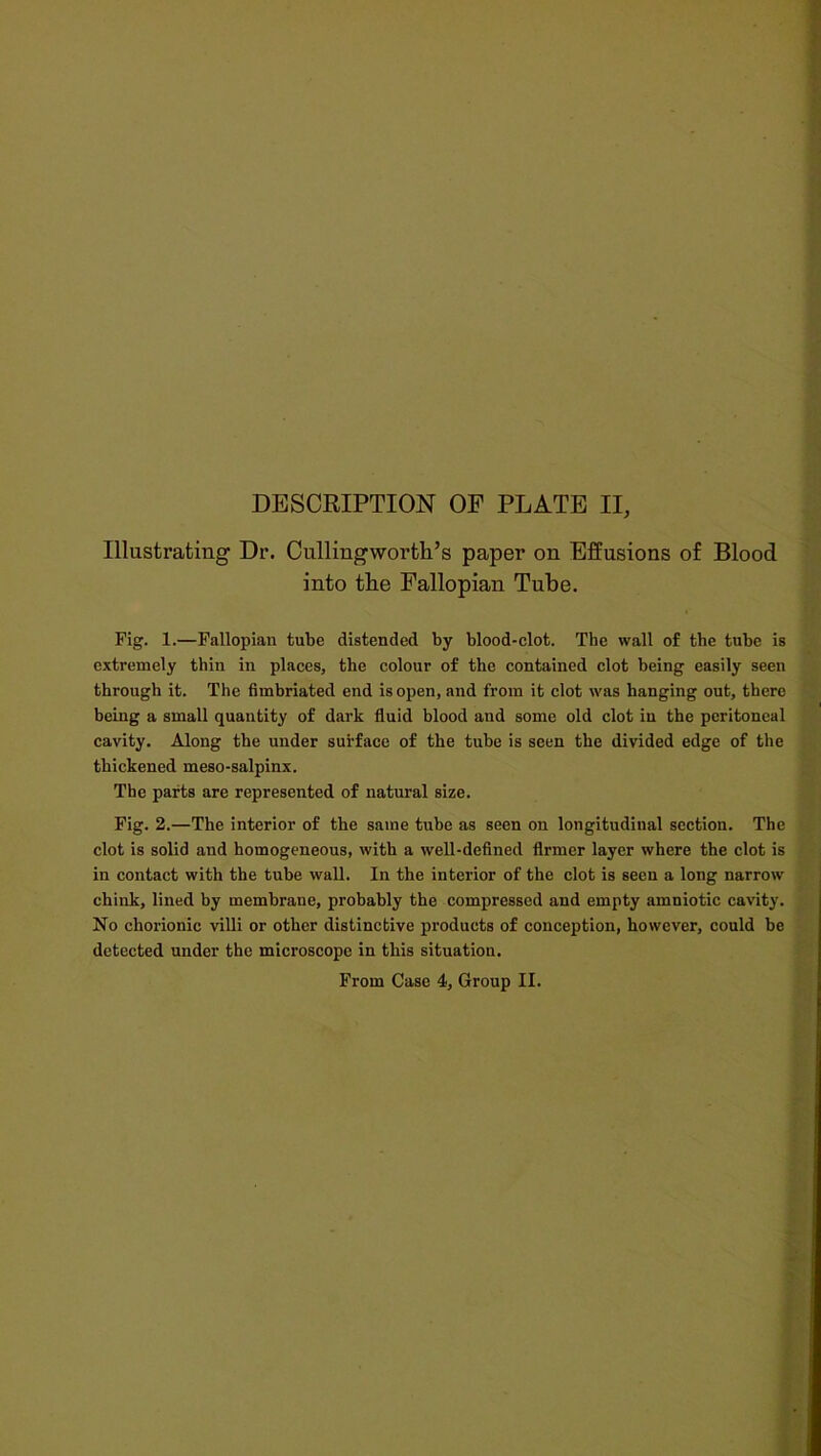 Illustrating Dr. Cullingworth’s paper on Effusions of Blood into tlie Fallopian Tube. Fig. 1.—Fallopian tube distended by blood-clot. The wall of the tube is extremely thin in places, the colour of the contained clot being easily seen through it. The fimbriated end isopen, and from it clot was hanging out, there being a small quantity of dark fluid blood and some old clot in the peritoneal cavity. Along the under surface of the tube is seen the divided edge of the thickened meso-salpinx. The parts are represented of natural size. Fig. 2.—The interior of the same tube as seen on longitudinal section. The clot is solid and homogeneous, with a well-defined firmer layer where the clot is in contact with the tube wall. In the interior of the clot is seen a long narrow' chink, lined by membrane, probably the compressed and empty amniotic cavity. No chorionic villi or other distinctive products of conception, however, could be detected under the microscope in this situation. From Case 4, Group II.