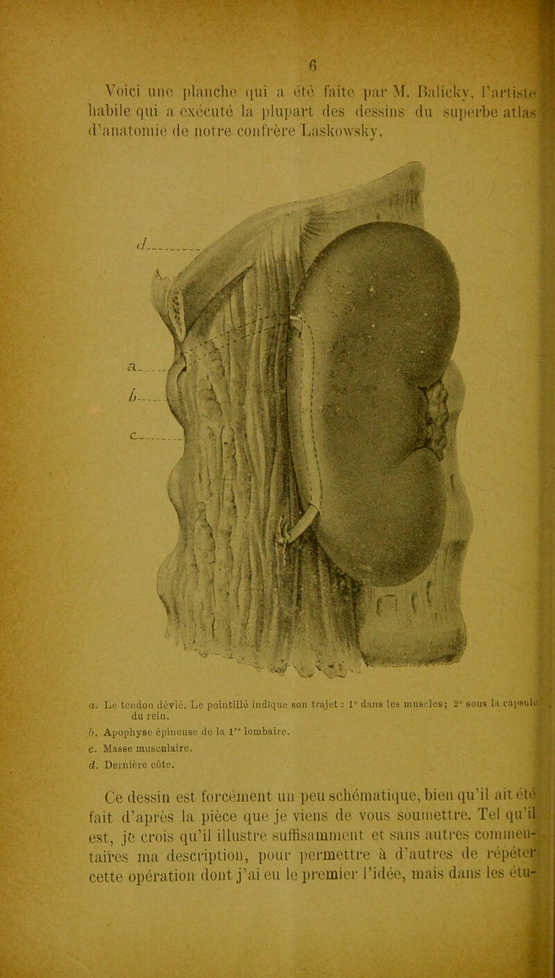 Voici une planche qui a été faite par M. Balickv. l’artiste habile qui a exécuté la plupart des dessins du superbe atlas d’anatomie de notre confrère Laskowsky. a. Le tendon dévié. Le pointillé indique son trajet : 1“ dans los muscles; 2“ sous la capsule’ j. du rein. b. Apophyse épineuse de la 1 lombaire. C. MasBe musculaire. d. Dernière côte. Ce dessin est forcément un peu schématique, bien qu’il ait été fait d’après la pièce que je viens de vous soumettre. Tel qu’il est, je crois qu’il illustre suffisamment et sans autres commen- taires ma description, pour permettre à d’autres de répéter cette opération dont j’ai eu le premier l’idée, mais dans les étu-