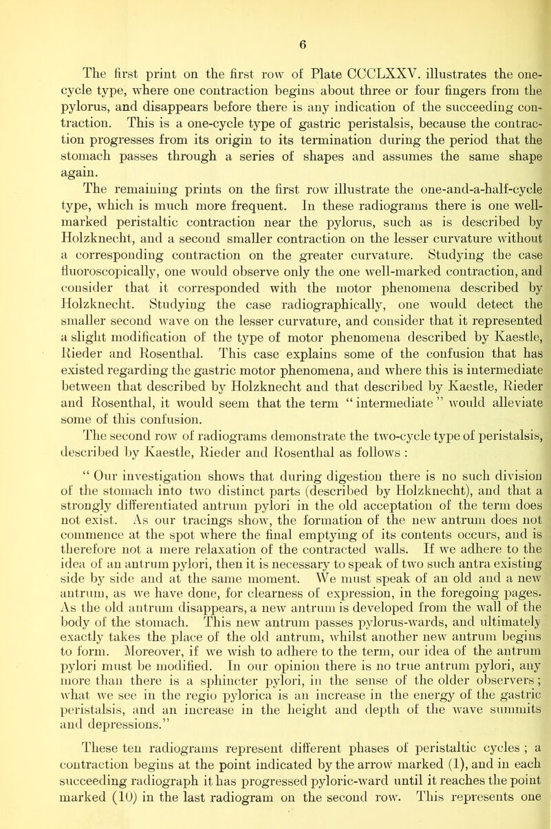 The first print on the first row of Plate OCCLXXV. illustrates the one- cycle type, where one contraction begins about three or four fingers from the pylorus, and disappears before there is any indication of the succeeding con- traction. This is a one-cycle type of gastric peristalsis, because the contrac- tion progresses from its origin to its termination during the period that the stomach passes through a series of shapes and assumes the same shape again. The remaining prints on the first row illustrate the one-and-a-half-cycle type, which is much more frequent. In these radiograms there is one well- marked peristaltic contraction near the pylorus, such as is described by Holzknecht, and a second smaller contraction on the lesser curvature without a corresponding contraction on the greater curvature. Studying the case fiuoroscopically, one would observe only the one well-marked contraction, and consider that it corresponded with the motor phenomena described by Holzknecht. Studying the case radiographically, one woidd detect the smaller second wave on the lesser curvature, and consider that it represented a slight modification of the t}^pe of motor phenomena described by Kaestle, Rieder and Rosenthal. This case explains some of the confusion that has existed regarding the gastric motor phenomena, and where this is intermediate between that described by Holzknecht and that described by Kaestle, Rieder and Rosenthal, it would seem that the term “intermediate” would alleviate some of this confusion. The second row of radiograms demonstrate the two-cycle type of peristalsis, described by Kaestle, Rieder and Rosenthal as follows : “ Our investigation shows that during digestion there is no such divisiou of the stomach into two distinct parts (described by Holzknecht), and that a strongly differentiated antrum pylori in the old acceptation of the term does not exist. As our tracings show, the formation of the new antrum does not commence at the spot where the final emptying of its contents occurs, and is therefore not a mere relaxation of the contracted walls. If we adhere to the idea of an antrum pylori, then it is necessary to speak of two such antra existing side by side and at the same moment. We must speak of an old and a new antrum, as we have done, for clearness of expression, in the foregoing pages. As the old antrum disappears, a new antrum is developed from the Avail of the body of the stomach. This new antrum passes pylorus-wards, and ultimately exactly takes the place of the old antrum, whilst another new antrum begins to form. Moreover, if Ave Avish to adhere to the term, our idea of the antrum pylori must be modified. In our opinion there is no true antrum pylori, any more than there is a sphincter pylori, in the sense of the older observers; Avhat Ave see in the regio pylorica is an increase in the energy of the gastric peristalsis, and an increase in the height and depth of the Avave summits and depressions.” These ten radiograms represent different phases of peristaltic cycles ; a contraction begins at the point indicated by the arrow marked (1), and in each succeeding radiograph it has progressed pyloric-Avard until it reaches the point marked (10) in the last radiogram on the second row. This represents one