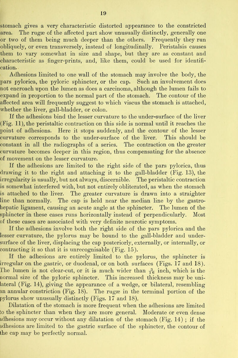 stomach gives a very characteristic distorted appearance to the constricted area. The rugae of the affected part show unusually distinctly, generally one or two of them being much deeper than the others. Frequently they run obliquely, or even transversely, instead of longitudinally. Peristalsis causes them to vary somewhat in size and shape, but they are as constant and characteristic as finger-prints, and, like them, could be used for identifi- cation. Adhesions limited to one wall of the stomach may involve the body, the pars pylorica, the pyloric sphincter, or the cap. Such an involvement does not encroach upon the lumen as does a carcinoma, although the lumen fails to expand in proportion to the normal part of the stomach. The contour of the affected area will frequently suggest to which viscus the stomach is attached, whether the liver, gall-bladder, or colon. If the adhesions bind the lesser curvature to the under-surface of the liver (Fig. 11), the peristaltic contraction on this side is normal until it reaches the point of adhesions. Here it stops suddenly, and the contour of the lesser curvature corresponds to the under-surface of the liver. This should be constant in all the radiographs of a series. The contraction on the greater curvature becomes deeper in this region, thus compensating for the absence of movement on the lesser curvature. If the adhesions are limited to the right side of the pars pylorica, thus drawing it to the right and attaching it to the gall-bladder (Fig. 13), the irregularity is usually, but not always, discernible. The peristaltic contraction is somewhat interfered with, but not entirely obliterated, as when the stomach is attached to the liver. The greater curvature is drawn into a straighter line than normally. The cap is held near the median line by the gastro- hepatic ligament, causing an acute angle at the sphincter. The lumen of the sphincter in these cases runs horizontally instead of perpendicularly. Most of these cases are associated with very definite neurotic symptoms. If the adhesions involve both the right side of the pars pylorica and the lesser curvature, the pylorus may be bound to the gall-bladder and under- surface of the liver, displacing the cap posteriorly, externally, or internally, or contracting it so that it is unrecognisable (Fig. 15). If the adhesions are entirely limited to the pylorus, the sphincter is irregular on the gastric, or duodenal, or on both surfaces (Figs. 17 and 18). The lumen is not clear-cut, or it is much wider than ^ inch, which is the normal size of the pyloric sphincter. This increased thickness may be uni- lateral (Fig. 14), giving the appearance of a wedge, or bilateral, resembling an annular constriction (Fig. 18). The rugae in the terminal portion of the pylorus show unusually distinctly (Figs. 17 and 18). Dilatation of the stomach is more frequent when the adhesions are limited to the sphincter than when they are more general. Moderate or even dense adhesions may occur without any dilatation of the stomach (Fig. 14) ; if the adhesions are limited to the gastric surface of the sphincter, the contour of the cap may be perfectly normal.