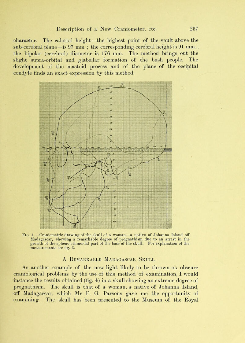 character. The calottal height—the highest point of the vault above the sub-cerebral plane—is 97 mm.; the corresponding cerebral height is 91 mm.; the bipolar (cerebral) diameter is 176 mm. The method brings out the slight supra-orbital and glabellar formation of the bush people. The development of the mastoid process and of the plane of the occipital condyle finds an exact expression by this method. Fig. 4.—Craniometrio drawing of the skull of a woman—a native of Johanna Island off Madagascar, showing a remarkable degree of prognathism due to an arrest in the growth of the spheno-ethmoidal part of the base of the skull. For explanation of the measurements see fig. 3. A Remarkable Madagascar Skull. As another example of the new light likely to be thrown oij. obscure craniological problems b)^ the use of this method of examination, I would instance the results obtained (fig. 4) in a skull showing an extreme degree of prognathism. The skull is that of a woman, a native of Johanna Island, off Madagascar, which Mr F. G. Parsons gave me the opportunity of examining. The skull has been presented to the Museum of the Royal