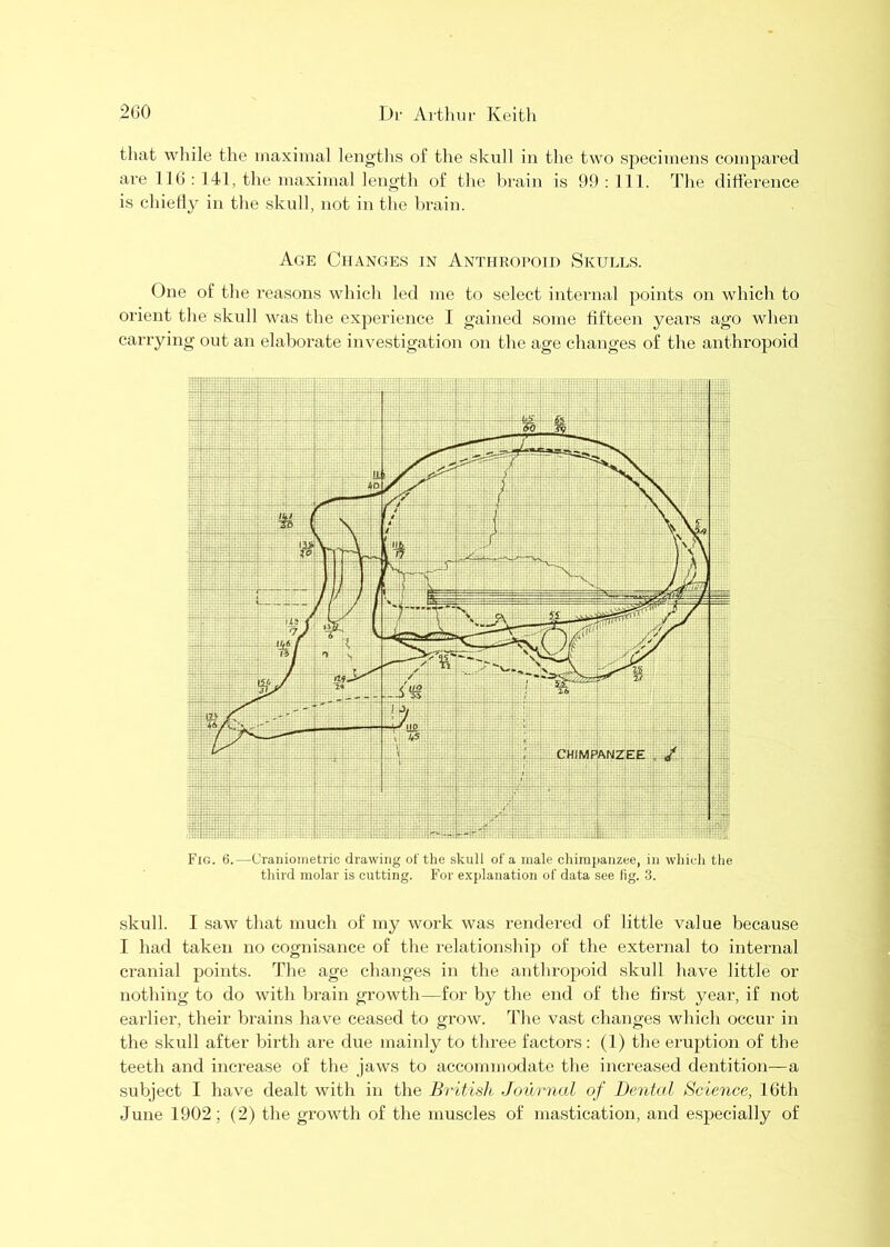 that while the maximal lengths of the sknll in the two sj)ecimens compared are 116 : 141, the maximal length of the brain is 90 : 11 1. The ditference is cliietly in the sknll, not in the brain. Age Changes in Anthropoid Skulls. One of the reasons which led me to select internal points on which to oi'ient the skidl was the experience I gained some fifteen years ago when carrying out an elabox-ate investigxrtion on the xxge changes of the anthropoid Fig. 6.—Craniometrio drawing of the skull of a male chimpanzee, in which the third molar is cutting. For explanation of data see fig. 3. skull. I saw that much of my work was rendered of little value because I had taken no cognisance of the relationship of the external to inteimal cranial points. The age changes in the xinthropoid skull have little or nothing to do with bi'ain growth—for by the end of the hi’st year, if not earlier, their brains have ceased to gi'ow. The vast changes which occur in the skull after birth are due maiidy to three factors : (1) the ei’uption of the teeth and increase of the jaws to accommodate the increased dentition—a subject I bave dealt with in tbe British, Journal of Dental Science, 16tb June 1902; (2) the growth of the muscles of mastication, and especially of