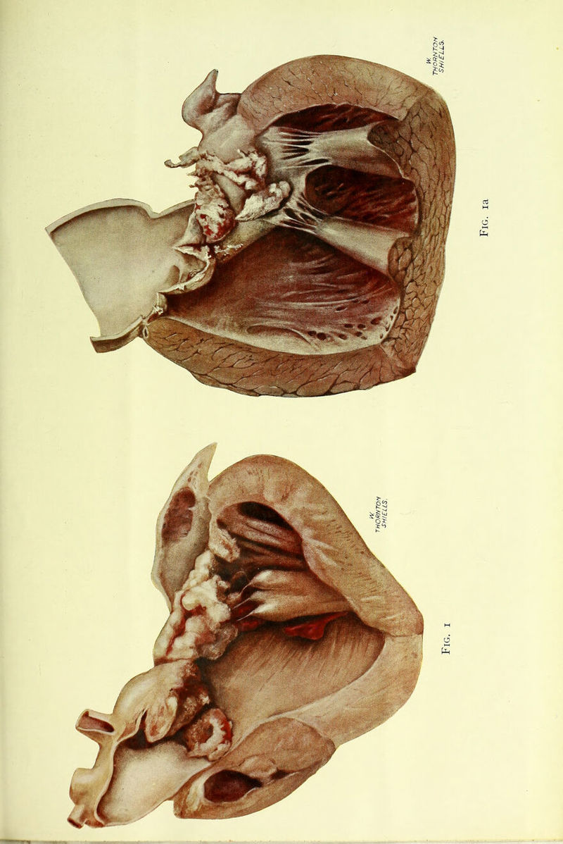 Fig. ia