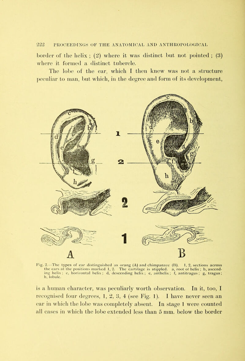 border of the helix ; (2) where it was distinct but not pointed ; (3) where it formed a distinct tubercle. The lolie of the ear, which I then knew was not a structure peculiar to man, but which, in the degree and form of its development, A B Fig. 2.—The types of ear distinguished as orang (A) and chimpanzee (B). 1, 2, sections across the ears at the positions marked 1, 2. The cartilage is stippled, a, root of helix ; b, ascend- ing helix; c, horizontal helix; d, descending helix; e, anthelix; f, antitragus; g, tragus; h, lobule. is a human character, was peculiarly worth observation. In it, too, I recognised foui* degrees, 1, 2, 3, 4 (see Fig. 1). I have never seen an ear in which the lobe was completely absent. In stage 1 were counted all cases in which the lobe extended less than 5 mm. below the border