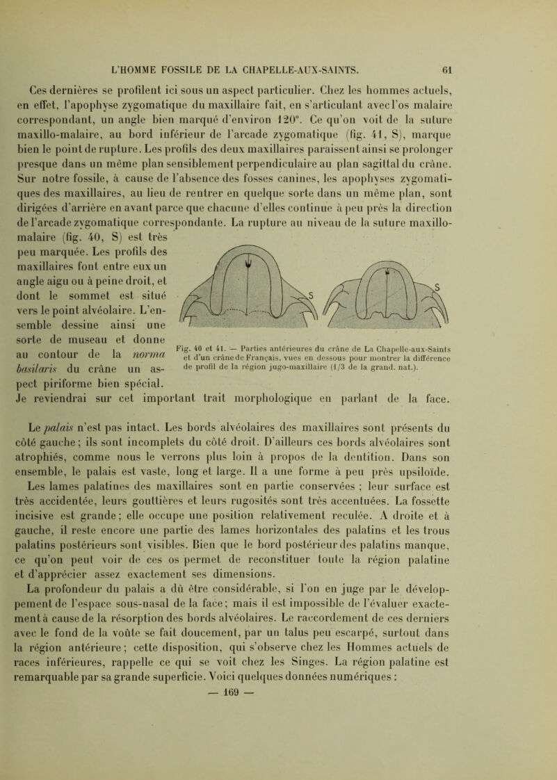 Ces dernières se profilent ici sous un aspect particulier. Chez les hommes actuels, en effet, l’apophyse zygomatique du maxillaire fait, en s’articulant avec l’os malaire correspondant, un angle bien marqué d’environ 120°. Ce qu’on voit de la suture maxillo-malaire, au bord inférieur de l’arcade zygomatique (fîg. 41, S), marque bien le point de rupture. Les profils des deux maxillaires paraissent ainsi se prolonger presque dans un même plan sensiblement perpendiculaire au plan sagittal du crâne. Sur notre fossile, à cause de l’absence des fosses canines, les apophyses zygomati- ques des maxillaires, au lieu de rentrer en quelque sorte dans un même plan, sont dirigées d’arrière en avant parce que chacune d’elles continue à peu près la direction de l’arcade zygomatique correspondante. La rupture au niveau de la suture maxillo- malaire (fig. 40, S) est très peu marquée. Les profils des maxillaires font entre eux un angle aigu ou à peine droit, et dont le sommet est situé vers le point alvéolaire. L’en- semble dessine ainsi une sorte de museau et donne au contour de la basilaris du crâne norma un as- Fig. 40 et 41. — Parties antérieures du crâne de La Chapelle-aux-Saints et d*un crâne de Français, vues en dessous pour montrer la différence de profil de la région jugo-maxillaire (1/3 de la grand, nat.). pect piriforme bien spécial. Je reviendrai sur cet important trait morphologique en parlant de la face. Le palais n’est pas intact. Les bords alvéolaires des maxillaires sont présents du côté gauche; ils sont incomplets du côté droit. D’ailleurs ces bords alvéolaires sont atrophiés, comme nous le verrons plus loin à propos de la dentition. Dans son ensemble, le palais est vaste, long et large. Il a une forme à peu près upsiloïde. Les lames palatines des maxillaires sont en partie conservées ; leur surface est très accidentée, leurs gouttières et leurs rugosités sont très accentuées. La fossette incisive est grande; elle occupe une position relativement reculée. A droite et à gauche, il reste encore une partie des lames horizontales des palatins et les trous palatins postérieurs sont visibles. Bien que le bord postérieur des palatins manque, ce qu’on peut voir de ces os permet de reconstituer toute la région palatine et d’apprécier assez exactement ses dimensions. La profondeur du palais a dù être considérable, si l’on en juge par le dévelop- pement de l’espace sous-nasal de la face; mais il est impossible de l’évaluer exacte- mentà cause de la résorption des bords alvéolaires. Le raccordement de ces derniers avec le fond de la voiite se fait doucement, par un talus peu escarpé, surtout dans la région antérieure; cette disposition, qui s’observe chez les Hommes actuels de races inférieures, rappelle ce qui se voit chez les Singes. La région palatine est remarquable par sa grande superficie. Voici quelques données numériques : — 169 —