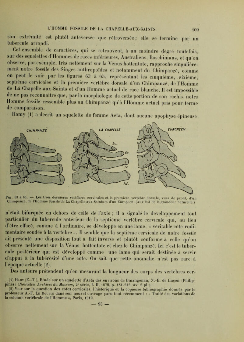 son extrémité est plutôt antéversée que rétroversée ; elle se termine par un tubercule arrondi. Cet ensemble de caractères, qui se retrouvent, à un moindre degré toutefois, sur des squelettes d’Hommes de races inférieures, Australiens, Boschimans, et qu’on observe, par exemple, très nettement sur la Vénus holtentote, rapproche singulière- ment notie fossile des Singes anthropoïdes et notamment du Chimpanzé, comme on peut le voir par les figures 63 à 63, représentant les cinquième, sixième, septième cervicales et la première vertèbre dorsale d’un Chimpanzé, de l’Homme de La Chapelle-aux-Saints et d un Homme actuel de race blanche. Il est impossible de ne pas reconnaître que, parla morphologie tle cette portion de son rachis, notre Homme fossile ressemble plus au Chimpanzé qu’à l'Homme actuel pris pour terme de comparaison. Hamy (1) a décrit un squelette de femme Aëta, dont aucune apophyse épineuse Fig. 63 à 65. — Les trois dernières vertèbres cervicales et la première vertèbre dorsale, vues de profil, d’un Chimpanzé, de 1 Homme fossile de La Chapelle-aux-Saints et d’un Européen. (Aux 2/3 de la grandeur naturelle.) n’était bifurquée en dehors de celle de l'axis ; il a signalé le développement tout particulier du tubercule antérieur de la septième vertèbre cervicale qui, au lieu d’être effacé, comme à l’ordinaire, se développe en une lame, « véritable côte rudi- mentaire soudée à la vertèbre ». Il semble que la septième cervicale de notre fossile ait présenté une disposition tout à fait inverse et plutôt conforme à celle qu’on observe nettement sur la Vénus hottentote et chez le Chimpanzé. Ici c’est le tuber- cule postérieur qui est développé comme une lame qui serait destinée à servir d’appui à la tubérosité d’une côte. On sait que cette anomalie n’est pas rare à l'époque actuelle (2). Des auteurs prétendent qu’en mesurant la longueur des corps des vertèbres cer- (1) Hamy (E.-T.), Etude sur un squelette d’Aëta des environs de Hinangonan, N.-E. de Luçon (Philip- pines) (Nouvelles Archives du Muséum, 2e série, t. Il, 1879, p. 181-212, av. 2 pi.). (2) Voir sur la question des côtes cervicales, l'historique et la copieuse bibliographie donnés par le professeur A.-F. Le Double dans son nouvel ouvrage paru tout récemment : « Traité des variations de la colonne vertébrale de l’Homme », Paris, 1912. — 93 —