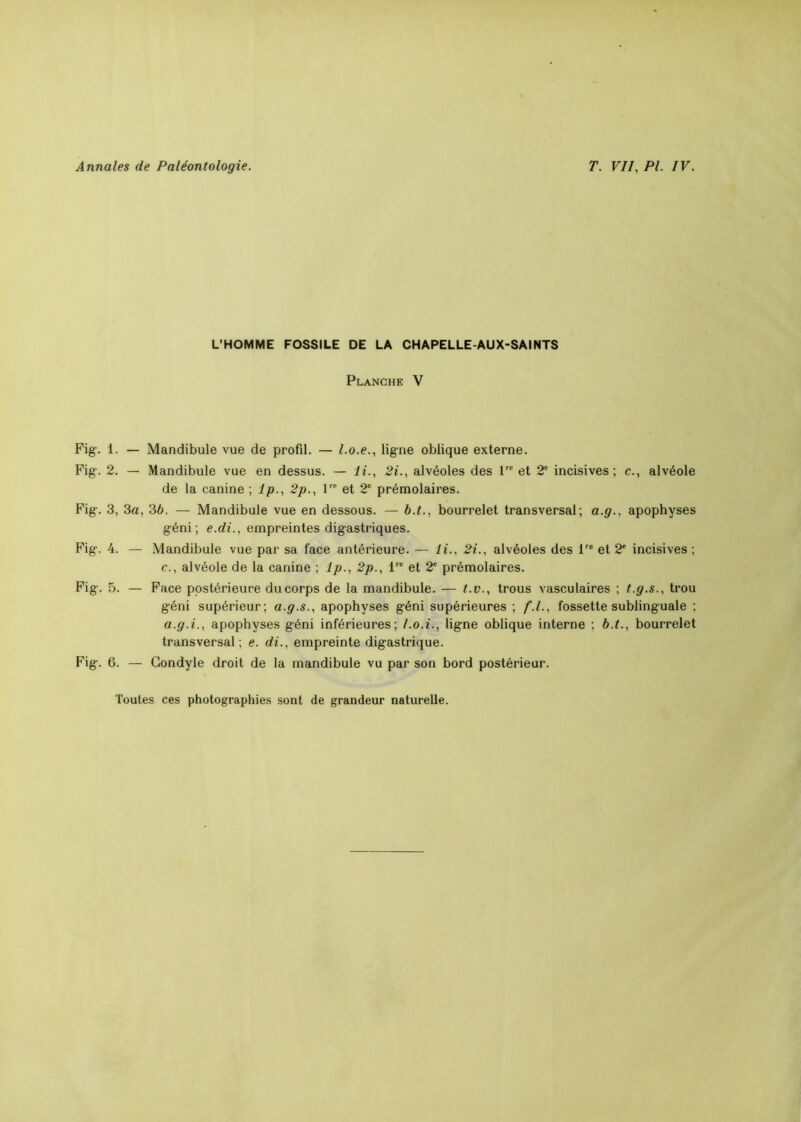 Fig-. 1. Fig. 2. Fig. 3, Fig. 4. Fig. 5. Fig. 6. L’HOMME FOSSILE DE LA CHAPELLE-AUX-SAINTS Planche V — Mandibule vue de profil. — l.o.e., ligne oblique externe. — Mandibule vue en dessus. — li., 2i., alvéoles des lre et 2e incisives; c., alvéole de la canine ,1p., 2p., lre et 2e prémolaires. 3a, 36. — Mandibule vue en dessous. — b.t., bourrelet transversal; a.g., apophyses géni ; e.di., empreintes digastriques. — Mandibule vue par sa face antérieure. — li., 2i., alvéoles des lre et 2' incisives ; c., alvéole de la canine ; lp., 2p., lre et 2e prémolaires. — Face postérieure du corps de la mandibule. — t.v., trous vasculaires ; t.g.s., trou géni supérieur; a.g.s., apophyses géni supérieures ; f.l., fossette sublinguale ; a.g.i., apophyses géni inférieures; l.o.i., ligne oblique interne ; b.t., bourrelet transversal; e. di., empreinte digastrique. — Gondyle droit de la mandibule vu par son bord postérieur. Toutes ces photographies sont de grandeur naturelle.