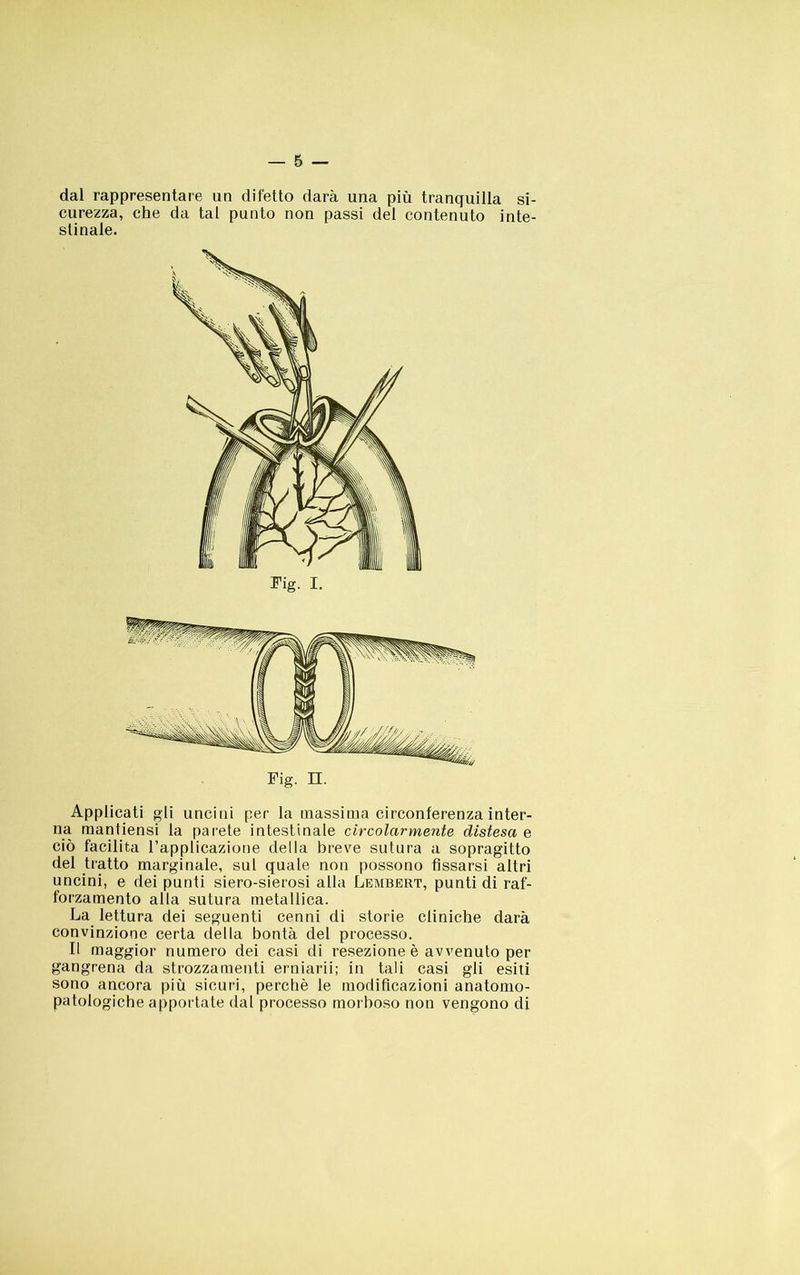 dal rappresentare un difetto darà una più tranquilla si- curezza, che da tal punto non passi del contenuto inte- stinale. Fig. I. Fig. n. Applicati gli uncini per la massima circonferenza inter- na mantiensi la parete intestinale circolarmente distesa e ciò facilita l’applicazione della breve sutura a sopragitto del tratto marginale, sul quale non possono fissarsi altri uncini, e dei punti siero-sierosi alla Lembert, punti di raf- forzamento alla sutura metallica. La lettura dei seguenti cenni di storie cliniche darà convinzione certa della bontà del processo. Il maggior numero dei casi di resezione è avvenuto per gangrena da strozzamenti erniarii; in tali casi gli esiti sono ancora più sicuri, perchè le modificazioni anatomo- patologiche apportate dal processo morboso non vengono di