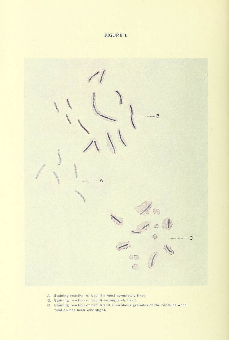 A. Staining reaction of bacilli almost completely fixed. B. Staining reaction of bacilli incompletely fixed. C. Staining reaction of bacilli and amorphous granules of the capsules when fixation has been very slight.