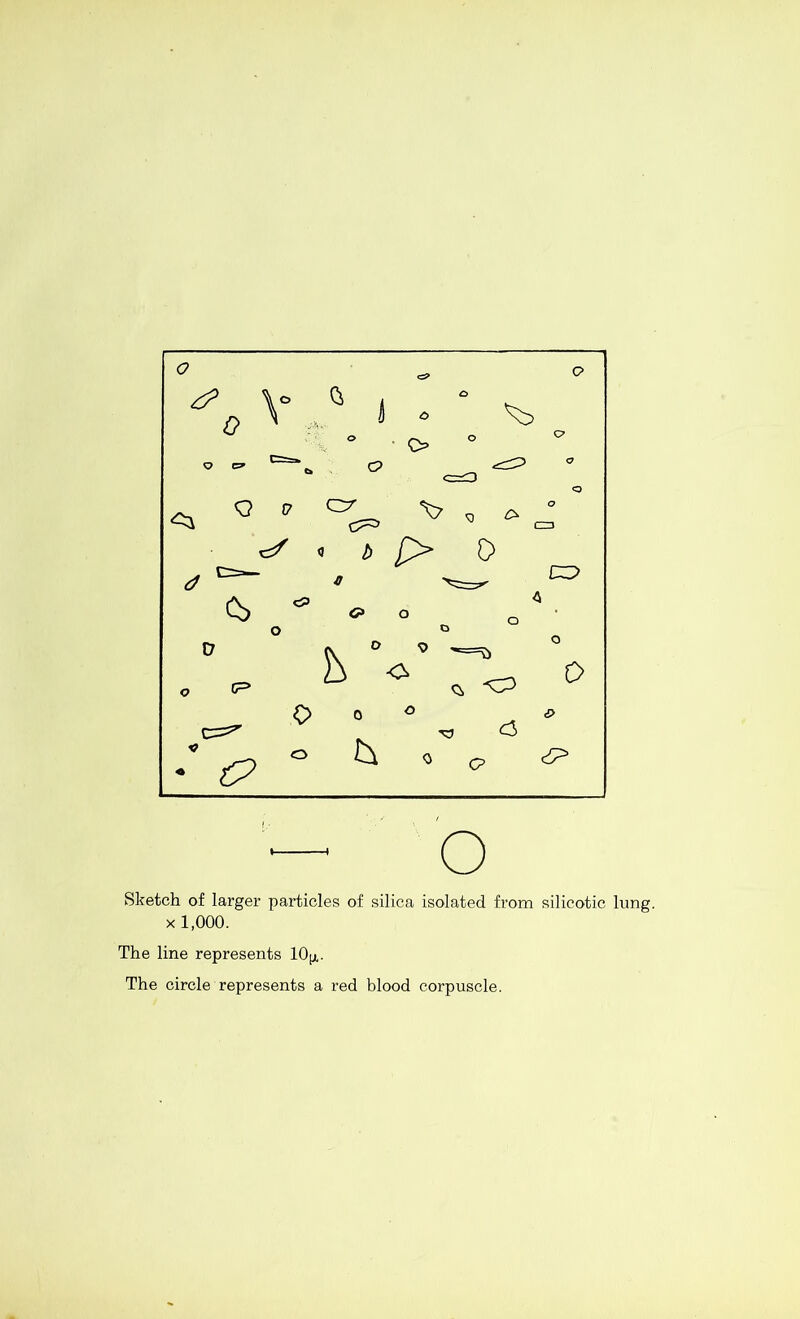 Sketch of larger particles of silica isolated from silicotic lung. X 1,000. The line represents lO^i. The circle represents a red blood corpuscle.