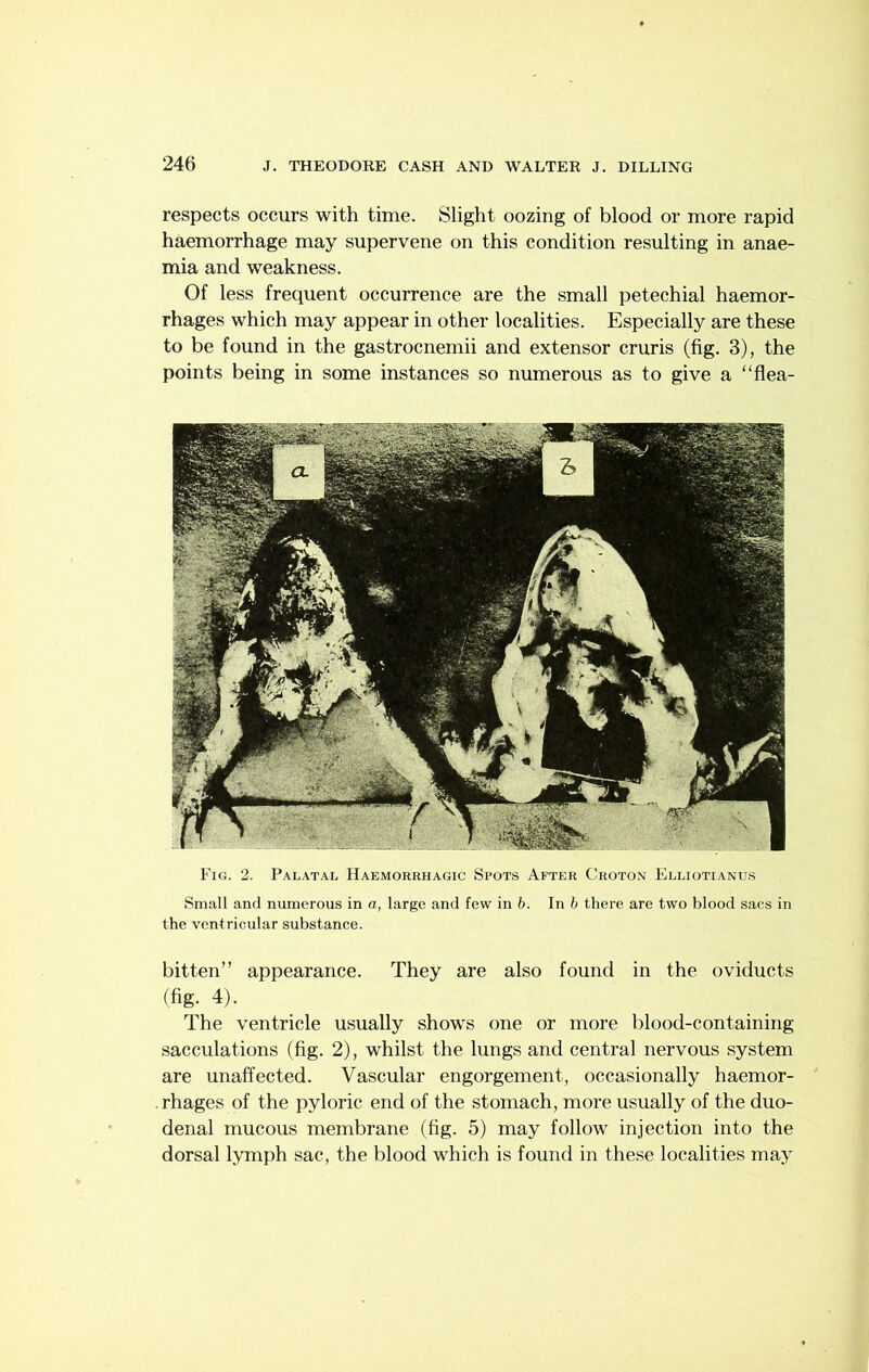 respects occurs with time. Slight oozing of blood or more rapid haemorrhage may supervene on this condition resulting in anae- mia and weakness. Of less frequent occurrence are the small petechial haemor- rhages which may appear in other localities. Especially are these to be found in the gastrocnemii and extensor cruris (fig. 3), the points being in some instances so numerous as to give a ‘‘flea- Fig. 2. Palatal Haemorrhagic Spots After Croton Elliotianus Small and numerous in o, large and few in b. In b there are two blood sacs in the ventricular substance. bitten” appearance. They are also found in the oviducts (fig. 4). The ventricle usually shows one or more blood-containing sacculations (fig. 2), whilst the lungs and central nervous system are unaffected. Vascular engorgement, occasionally haemor- . rhages of the pyloric end of the stomach, more usually of the duo- denal mucous membrane (fig. 5) may follow injection into the dorsal lymph sac, the blood which is found in these localities may