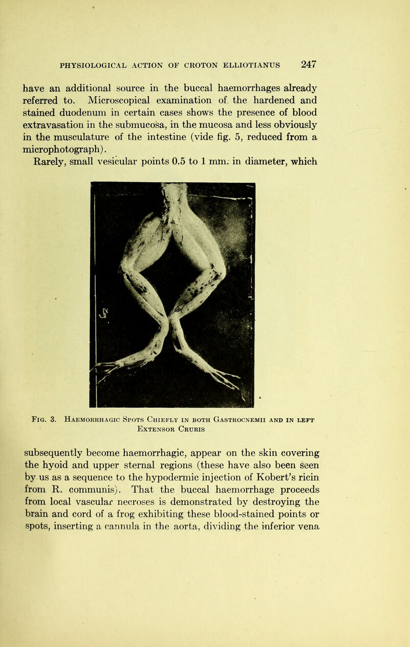 have an additional source in the buccal haemorrhages already referred to. Microscopical examination of the hardened and stained duodenum in certain cases shows the presence of blood extravasation in the submucosa, in the mucosa and less obviously in the musculatm-e of the intestine (vide fig. 5, reduced from a microphotograph). Rarely, small vesicular points 0.5 to 1 mm. in diameter, which subsequently become haemorrhagic, appear on the skin covering the hyoid and upper sternal regions (these have also been seen by us as a sequence to the hypodermic injection of Robert’s ricin from R. communis). That the buccal haemorrhage proceeds from local vascular necroses is demonstrated by destroying the brain and cord of a frog exhibiting these blood-stained points or spots, inserting a cannula in the aorta, dividing the inferior vena