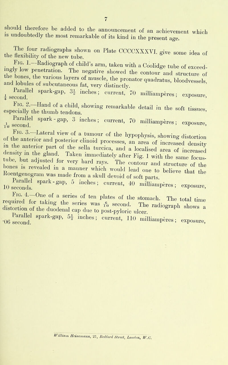 7 should therefore be added to the announcement of an achievement which IS undoubtedly the most remarkable of its kind in the present age. radiographs shown on Plate CCCCXXXVI. give some idea of the flexibility of the new tube. ^ _ Fig. l.-Radiograph of child’s arm, taken with a Coolidge tube of exceed- mgly low penetration. The negative showed the contour and structure of !nd^°ri’ pronator quadratus, bloodvessels and lobules of subcutaneous fat, very distinctly. ’ i second.*'’' <0 milliampires; exposure, ^ remarkable detail in the soft tissues especially the thumb tendons. tissues, i^os^cond^ spark-gap, 3 inches; current, 70 milliamperes; exposure, nf ^;“^'^^®ral view of a tumour of the hypophysis, showing distortion _ e anteiior and posterior clinoid processes, an area of increased density m tie anterior part of the sella turcica, and a localised area of increased tube b 7 d^ 777 ^^fter Fig. 1 with the same focus- idie, but adjusted for very bard rays. The contour and structure of the bones is revealed in a manner which would lead one to believe that tlie Roentgenogram was made from a skull devoid of soft parts 10sec7nd7 ^ 40 milliamperes; exposure. Fig 4.-One of a series of ten plates of the stomach. The total time required for taking the series was second. The radiograph sho7s a distoition of the duodenal cap due to post-pyloric ulcer. •06 second' milliamperes; e.xposure,