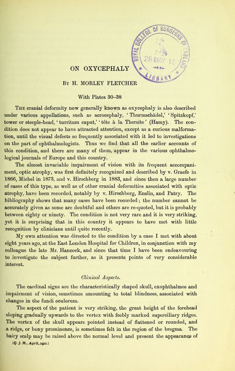 By H. MORLEY FLETCHER With Plates 30-38 The cranial deformity now generally known as oxycephaly is also described under various appellations, such as acrocephaly, ‘ Thurmschadel,’ ‘ Spitzkopf,’ tower or steeple-head, ‘ turritum caput,’ ‘ tete a la Thersite ’ (Hamy). The con- dition does not appear to have attracted attention, except as a curious malforma- tion, until the visual defects so frequently associated with it led to investigations on the part of ophthalmologists. Thus we find that all the earlier accounts of this condition, and there are many of them, appear in the various ophthalmo- logical journals of Europe and this country. The almost invariable impairment of vision with its frequent accompani- ment, optic atrophy, was first definitely recognized and described by v. Graefe in 1866, Michel in 1873, and v. Hirschberg in 1883, and since then a large number of cases of this type, as well as of other cranial deformities associated with optic atrophy, have been recorded, notably by v. Hirschberg, Enslin, and Patry. The bibliography shows that many cases have been recorded; the number cannot be accurately given as some are doubtful and others are re-quoted, but it is probably between eighty or ninety. The condition is not very rare and it is very striking, yet it is surpi-ising that in this country it appears to have met with little recognition by clinicians until quite recently. My own attention was directed to the condition by a case I met with about eight years ago, at the East London Hospital for Children, in conjunction with my colleague the late Mr. Hancock, and since that time I have been endeavouring to investigate the subject further, as it presents points of very considerable interest. Clinical Aspects. The cardinal signs are the characteristically shaped skull, exophthalmos and impairment of vision, sometimes amounting to total blindness, associated with changes in the fundi oculorum. The aspect of the patient is very striking, the great height of the forehead sloping gradually upwards to the vertex with feebly marked superciliary ridges. The vertex of the skull appears pointed instead of flattened or rounded, and a ridge, or bony prominence, is sometimes felt in the region of the bregma. The hairy scalp may be raised above the normal level and present the appearance of IQ. J. M., April, 1911.]