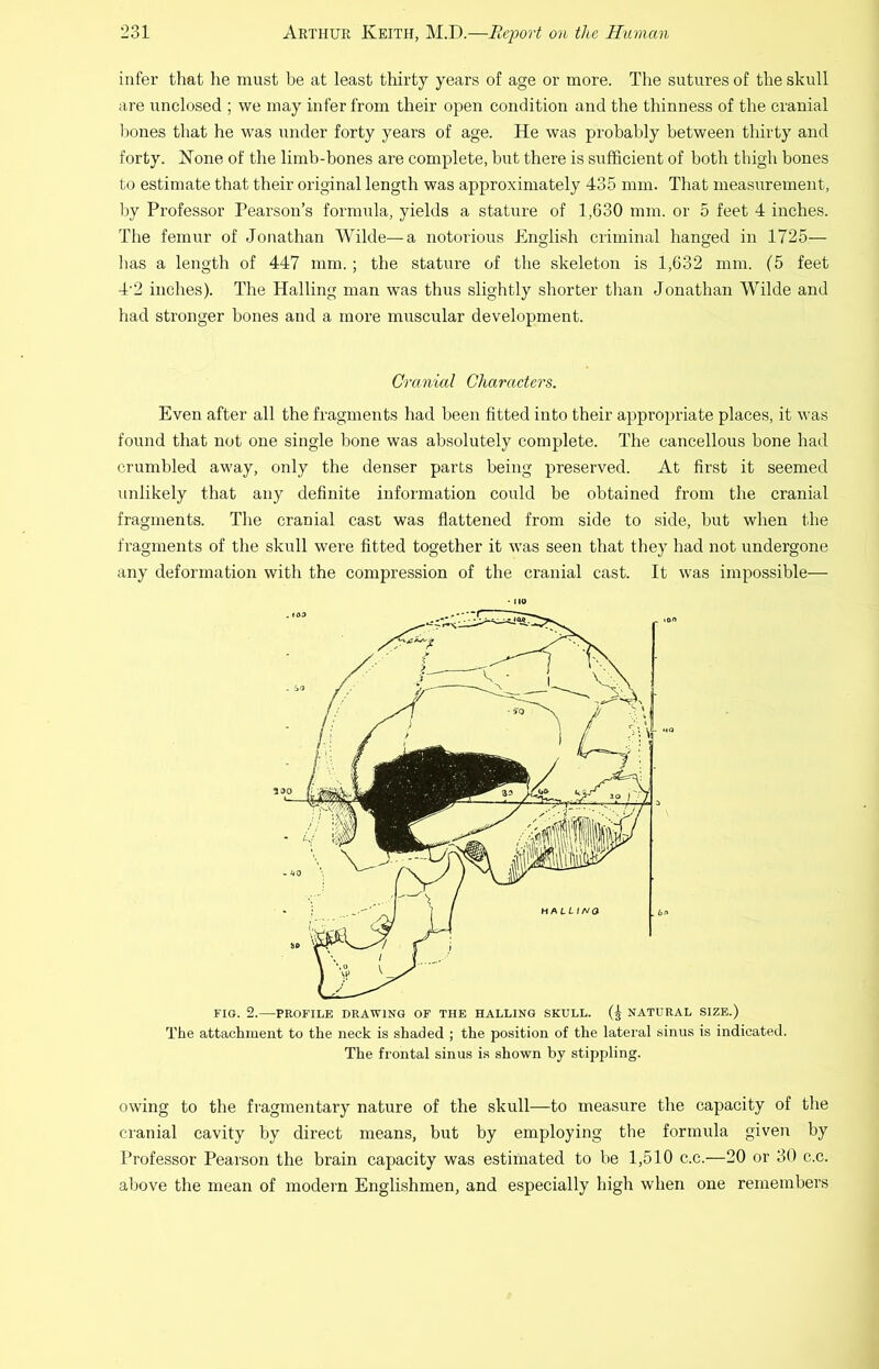 infer that he must be at least thirty years of age or more. The sutures of the skull are unclosed ; we may infer from their open condition and the thinness of the cranial liones that he was under forty years of age. He was probably between thirty and forty. None of the limb-bones are complete, but there is sufficient of both thigh bones to estimate that their original length was approximately 435 mm. That measurement, liy Professor Pearson’s formula, yields a stature of 1,630 mm. or 5 feet 4 inches. The femur of Jonathan Wilde—a notorious English criminal hanged in 1725— has a length of 447 mm.; the statiu’e of the skeleton is 1,632 mm. (5 feet 4’2 inches). The Hailing man was thus slightly shorter than Jonathan Wilde and had stronger bones and a more muscular development. Cranial Characters. Even after all the fragments had been fitted into their appropriate places, it was found that not one single bone was absolutely complete. The cancellous bone had crumbled away, only the denser parts being preserved. At first it seemed unlikely that any definite information could be obtained from the cranial fragments. The cranial cast was flattened from side to side, but when the fragments of the skull were fitted together it was seen that they had not undergone any deformation with the compression of the cranial cast. It was impossible— ' no FIG. 2.—PROFILE DRAWING OF THE BALLING SKULL. NATURAL SIZE.) The attachment to the neck is shaded ; the position of the lateral sinus is indicated. The frontal sinus is shown by stippling. owing to the fragmentary nature of the skull—to measure the capacity of the cranial cavity by direct means, but by employing the formula given by Professor Pearson the brain capacity was estimated to be 1,510 c.c.—20 or 30 c.c. above the mean of modern Englishmen, and especially high when one remembers