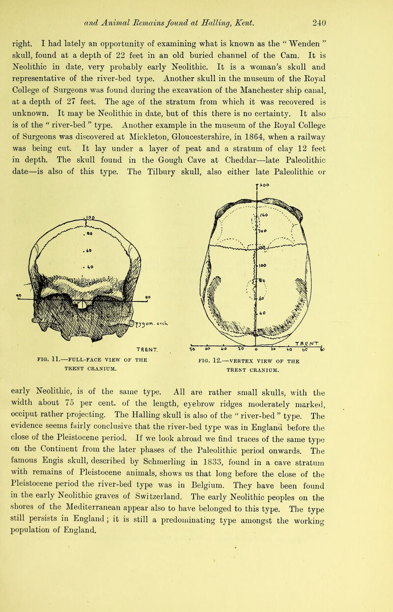 right. I had lately an opportunity of examining what is known as the “ Wenden ” skull, found at a depth of 22 feet in an old buried channel of the Cam. It is ISTeolithic in date, very probably early Neolithic. It is a woman’s skull and representative of the river-bed type. Another skull in the museum of the Eoyal College of Surgeons was found during the excavation of the Manchester ship canal, at a depth of 27 feet. The age of the stratum from which it was recovered is unknown. It may be Neolithic in date, hut of this there is no certainty. It also is of the “ river-bed ” type. Another example in the museum of the Eoyal College of Surgeons was discovered at Mickleton, Gloucestershire, in 1864, when a railway was being cut. It lay under a layer of peat and a stratum of clay 12 feet in depth. The skull found in the Gough Cave at Cheddar—-late Paleolithic date—is also of this type. The Tilbury skull, also either late Paleolithic or early Neolithic, is of the same type. All are rather small skulls, with the width about 75 per cent, of the length, eyebrow ridges moderately marked, occiput rather projecting. The Hailing skull is also of the “ river-bed ” type. The evidence seems fairly conclusive that the river-bed type was in England before the close of the Pleistocene period. If we look abroad we find traces of the same type on the Continent from the later phases of the Paleolithic period onwards. The famous Engis skull, described by Schmerling in 1833, found in a cave stratum with remains of Pleistocene animals, shows us that long before the close of the Pleistocene period the river-bed type was in Belgium. They have been found in the early Neolithic graves of Switzerland. The early Neolithic peoples on the shores of the Mediterranean appear also to have belonged to this type. The type still persists in England ; it is still a predominating type amongst the working population of England. TRENT. FIG. 11.—FULL-FACE VIEW OF THE TRENT CRANIUM. FIG. 12.—VERTEX VIEW OF THE TRENT CRANIUM.