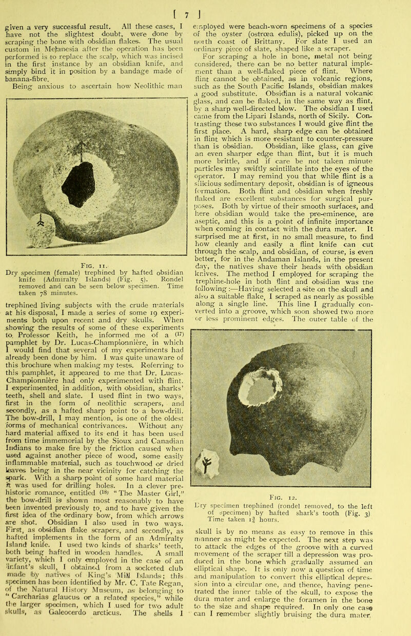 given a very successful result. All these cases, I have not the slightest doubt, rvere dbne by scraping the bone with obsidian flakes. The usual custom in Melanesia after the operation has been performed is to replace the scalp, which was incised in the first instance by an obsidian knife, and simply bind it in position by a bandage made of banana-fibre. Being anxious to ascertain how Neolithic man Fig. II. Dry specimen (female) trephined by halted obsidian knife (Admiralty Islands) (Fig. 5). Rondel removed and can be seen below specimen. Time taken 78 minutes. trephined living subjects with the crude n:aterials at his disposal, I made a series of some 19 experi- ments both upon recent and dry skulls. VVhen showing the results of some of these experiments to. Professor Keith, he informed me of a (ii) pamphlet by Dr. Lucas-Championniere, in which I would find that several of my experiments had already been done by him. I was quite unaware of this brochure when making my te.sts. Referring to this pamphlet, it appeared to me that Dr. Lucas- Championni^re had only experimented with flint. I experimented^ in addition, with obsidian, sharks’ teeth, shell and slate. I used flint in two ways, first in the form of neolithic scrapers, and secondly, as a hafted sharp point to a bow-drill. The bow-drill, I may mention, is one of the oldest forms of mechanical contrivances. Without anv hard material affixed to its end it has been used from time immemorial by the Sioux and Canadian Indians to make fire by the friction caused when used against another piece of wood, some easily inflammable material, such as touchwood or dried leaves being in the near vicinity for catching the ^ark. With a sh.arp point of some hard material 'ft was used for drilling holes. In a clever pre- historic romance, entitled (18) “The Master Girl,” tlie bow-drill is shown most reasonably to have been invented previously to, and to have’given the first idea of the ordinary bow, from which arrows are shot. Obsidian I also used in two ways. First, as obsidian flake .scrapers, and secondly, as hafted irnplements in the form of an Admiralty Island knife. I used two kinds of sharks’ teeth, both bein.g hafted in wooden handles. A small variety, which I only employed in the case of an infant’s skull, I obtained from a .socketed club maille b'y nativu'S ol' King’s MiW r.sja,ndi.si; this specimen has been identified by Mr. C. Tate Regan, of ^the Natural Jlis'tory Museum, as belonging to ‘‘Carcharias glaucus or a related species,” while tie larger specimen, which I used for two adult skulbs, as Galeocerdo arcticus. The shells 1 e:riployed were beacli-worn specimens of a species o;f the oyster (ostroea edulis), picked up on the north coast of Brittany. For slate I used an ordinary piece of slate, shaped like a scraper. For scraping a hole in bone, metal not being considered, there can be no better natural imple- ment than a well-flaked piece of flint. Where flint cannot be obtained, as in volcanic regions, such as the South Pacific Islands, obsidian makes a good substitute. Obsidian is a natural volcanic glass, and can be flaked, in the same way as flint, by a sharp well-directed blow. Tlie obsidian I used came from the Lipari Islands, north of Sicily. Con- ti asting these two substances I would give flint the first place. A hard, sharp edge can be obtained in flint which is more resistant to counter-pressure than is obsidian. Obsildian, like glass, can give an even sharper edge than flint, but it is much more brittle, and if care be not taken minute particles may swiftly scintillate into the eyes of the operator. 1 may remind you that while flint is a siiicious sedimentary deposit, obsidian is of igneous f(>rmation. Both flint and obsidian when freshly flaked are excellent substances for surgical pur- po.ses. Both by virtue of their smooth surfaces, and here obsidian would take the pre-eminence, are a.septic, and this is a point of infinite importance when coming in contact with the dura m.ater. It surprised me at first, in no small measure, to find how cleanly and easily a flint knife can cut through the scalp, and obsidian, of course, is even belter, for in the Andaman Islands, in the present day, the natives shave their heads with obsidian knives. The method I employed for scraping the trephine-hole in both flint and obsidian was ttie following ;—Having selected a site on the skull and also a suitable Hake, I scraped as nearly as possible along a single line. This line I gradually con- verted into a groove, which soon showed two more or less prominent edges. The outer table of the Fig. 12. Fry specimen trephined (rondel removed, to the left of specimen) by hafted shark’s tooth (Fig. 3) Time taken i| hours. skull is by no means as easy to remove in this m.anner as might be expected. The next step was to attack the edges of the groove with a curved movement of the scraper till a depression was pro- duced in the bone which gradually assumed an elliptical shape. It is only now a question of time aru.1 manipulation to convert this elliptical depres- sion into a circular one, and thence, having pene- trated the inner table of the skull, to expo.se the dura mater and enlarge the foramen in the bone U'- the size and shape required. In only one case can I remember slightly bruising the dura mater,