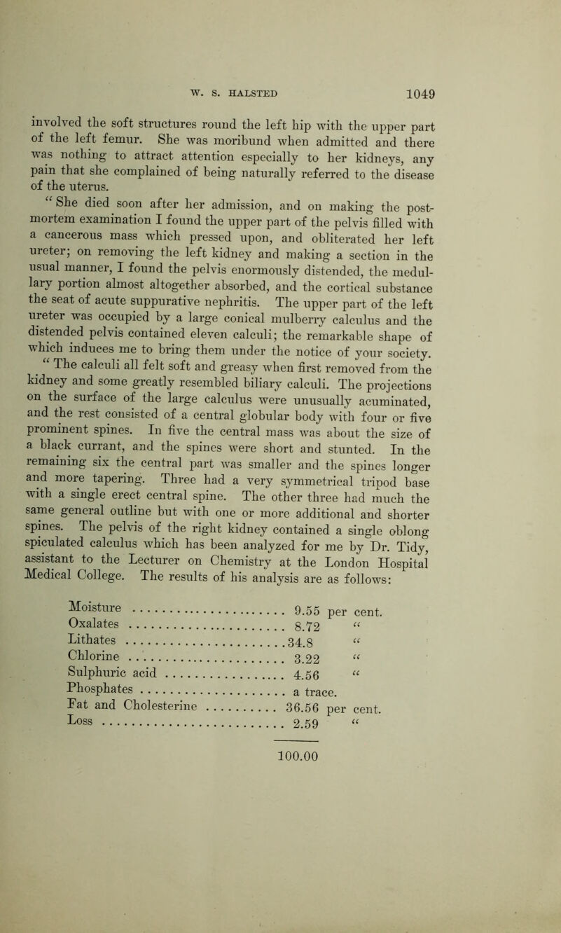 involved the soft structures round the left hip with the upper part of the left femur. She was moribund when admitted and there was nothing to attract attention especially to her kidneys, any pain that she complained of being naturally referred to the disease of the uterus. “ She died soon after her admission, and on making the post- mortem examination I found the upper part of the pelvis filled with a cancerous mass which pressed upon, and obliterated her left ureter; on removing the left kidney and making a section in the usual manner, I found the pelvis enormously distended, the medul- lary portion almost altogether absorbed, and the cortical substance the seat of acute suppurative nephritis. The upper part of the left ureter was occupied by a large conical mulberry calculus and the distended pelvis contained eleven calculi; the remarkable shape of Vi hich induces me to bring them under the notice of your society. The calculi all felt soft and greasy when first removed from the kidney and some greatly resembled biliary calculi. The projections on the surface of the large calculus were unusually acuminated, and the rest consisted of a central globular body with four or five prominent spines. In five the central mass was about the size of a black currant, and the spines were short and stunted. In the remaining six the central part was smaller and the spines longer and more tapering. Three had a very symmetrical tripod base with a single erect central spine. The other three had much the same general outline but with one or more additional and shorter spines. The pelvis of the right kidney contained a single oblong spiculated calculus which has been analyzed for me by Dr. Tidy, assistant to the Lecturer on Chemistry at the London Hospital Medical College. The results of his analysis are as follows: per cent. U Moisture 9 55 Oxalates g.72 Lithates 34.3 “ Chlorine 3 22 “ Sulphuric acid 4.56 “ Phosphates a trace. Pat and Cholesterme 36.56 per cent Loss 2.59 “ 100.00