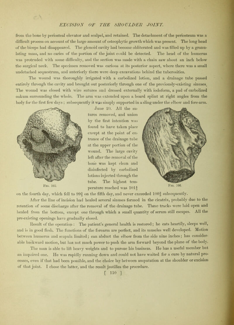 EXCISION OF TI1E SHOULDER JOINT. from the bone by periosteal elevator and scalpel, and retained. The detachment of the periosteum was a difficult process on account of the large amount of osteophytic growth which was present. The long head of the biceps had disappeared. The glenoid cavity had become obliterated and was tilled up by a granu- lating mass, and no caries of the portion of the joint could be detected. The head of the humerus was protruded with some difficulty, and the section was made with a chain saw about an inch below the surgical neck. The specimen removed was carious at its posterior aspect, where there was a small undetached sequestrum, and anteriorly there were deep excavations behind the tuberosities. The wound was thoroughly irrigated with a carbolized lotion, and a drainage tube passed entirely through the cavity and brought out posteriorly through one of the previously-existing sinuses. The wound was closed with wire sutures and dressed externally with iodoform, a pad of carbolized oakum surrounding the whole. The arm was extended upon a board splint at right angles from the body for the first few days ; subsequently it was simply supported in a sling under the elbow and fore-arm. June 20. All the su- tures removed, and union by the first intention was found to have taken place except at the point of en- trance of the drainage tube at the upper portion of the wound. The large cavity left after the removal of the bone was kept clean and disinfected by carbolized lotions injected through the tube. The highest tem- Fig. 105. , -i , -\c\a\ Fig. 106. perature reached was 101-g on the fourth day, which fell to 99f on the fifth day, and never exceeded lOOf subsequently. After the line of incision had healed several sinuses formed in the cicatrix, probably due to the retention of some discharge after the removal of the drainage tube. These tracks were laid open and healed from the bottom, except one through which a small quantity of serum still escapes. All the pre-existing openings have gradually closed. Result of the operation : The patient’s general health is restored ; he eats heartily, sleeps well, and is in good flesh. The functions of the forearm are perfect, and its muscles well developed. Motion between humerus and scapula limited; can abduct the elbow from the side nine inches; has consider- able backward motion, but has not much power to push the arm forward beyond the plane ot the bod}'. The man is able to lift heavy weights and to pursue his business. He has a useful member but an impaired one. He was rapidly running down and could not have waited for a cure by natural pro- cesses, even if that had been possible, and the choice lay between amputation at the shoulder or excision of that joint. I chose the latter, and the result justifies the procedure. [ no 1