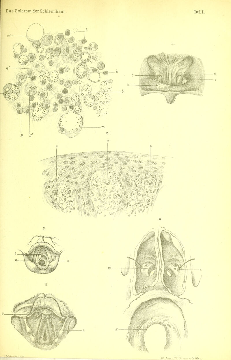 f 1 Das Sclerom derScMeirnliam. Taf.I 3. ^ -F.TVtftj-Vnpr (lpl;-n 70- LüK.Anst.v.Tk’Banmrarft'Wieu,