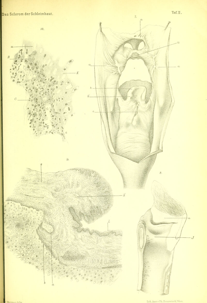 ll ^1 Meix7ipr rlpTiii bas Sclerom derScMeimliaur. Taf.H 7. Anst .V Tk B nim-vvri