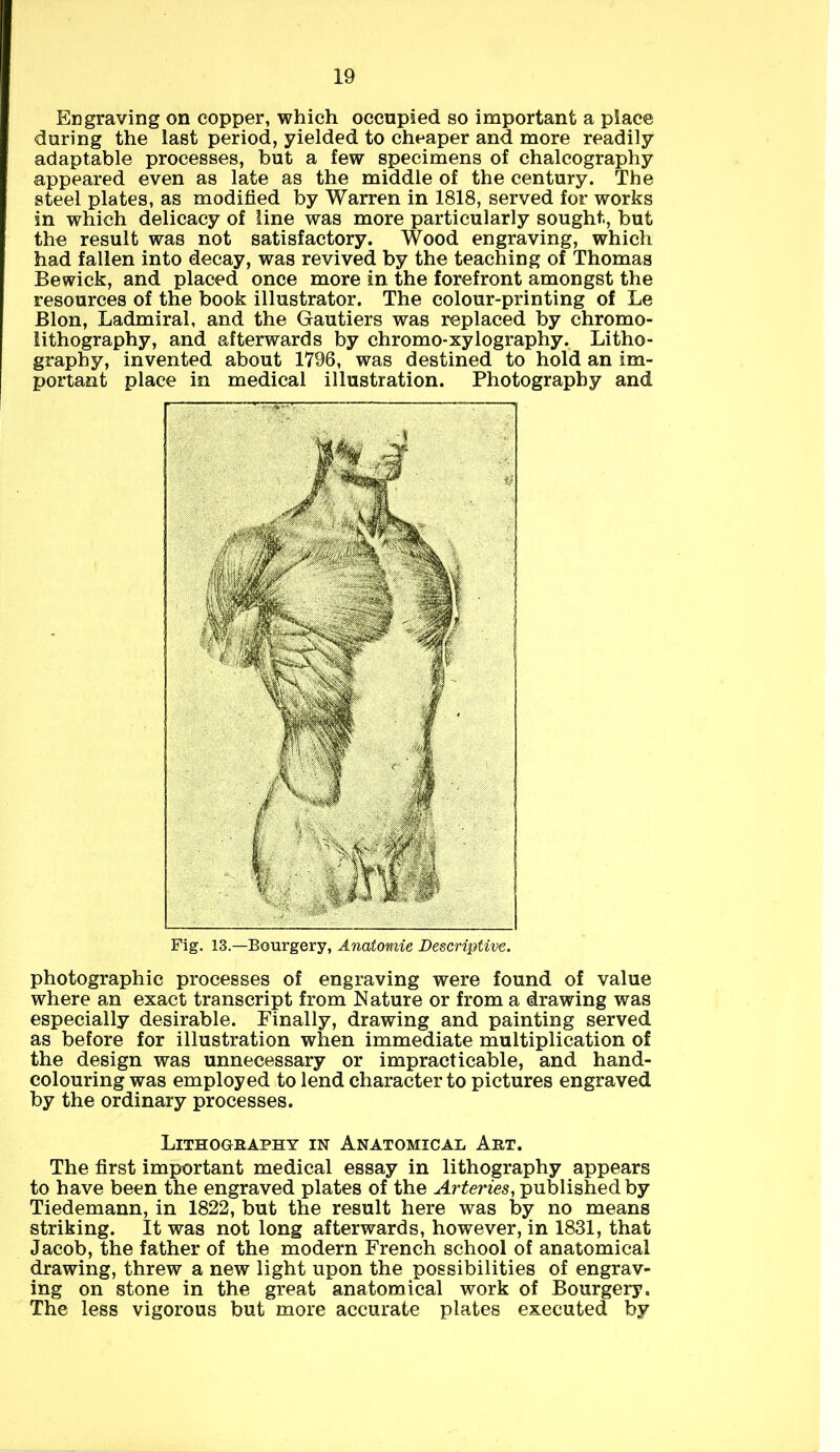 Engraving on copper, which occupied so important a place during the last period, yielded to cheaper and more readily adaptable processes, but a few specimens of chalcography appeared even as late as the middle of the century. The steel plates, as modified by Warren in 1818, served for works in which delicacy of line was more particularly sought, but the result was not satisfactory. Wood engraving, which had fallen into decay, was revived by the teaching of Thomas Bewick, and placed once more in the forefront amongst the resources of the book illustrator. The colour-printing of Le Blon, Ladmiral, and the Gautiers was replaced by chromo- lithography, and afterwards by chromo-xylography. Litho- graphy, invented about 1796, was destined to hold an im- portant place in medical illustration. Photography and photographic processes of engraving were found of value where an exact transcript from Nature or from a drawing was especially desirable. Finally, drawing and painting served as before for illustration when immediate multiplication of the design was unnecessary or impracticable, and hand- colouring was employed to lend character to pictures engraved by the ordinary processes. Lithography in Anatomical Art. The first important medical essay in lithography appears to have been the engraved plates of the Arteries, published by Tiedemann, in 1822, but the result here was by no means striking. It was not long afterwards, however, in 1831, that Jacob, the father of the modern French school of anatomical drawing, threw a new light upon the possibilities of engrav- ing on stone in the great anatomical work of Bourgery. The less vigorous but more accurate plates executed by